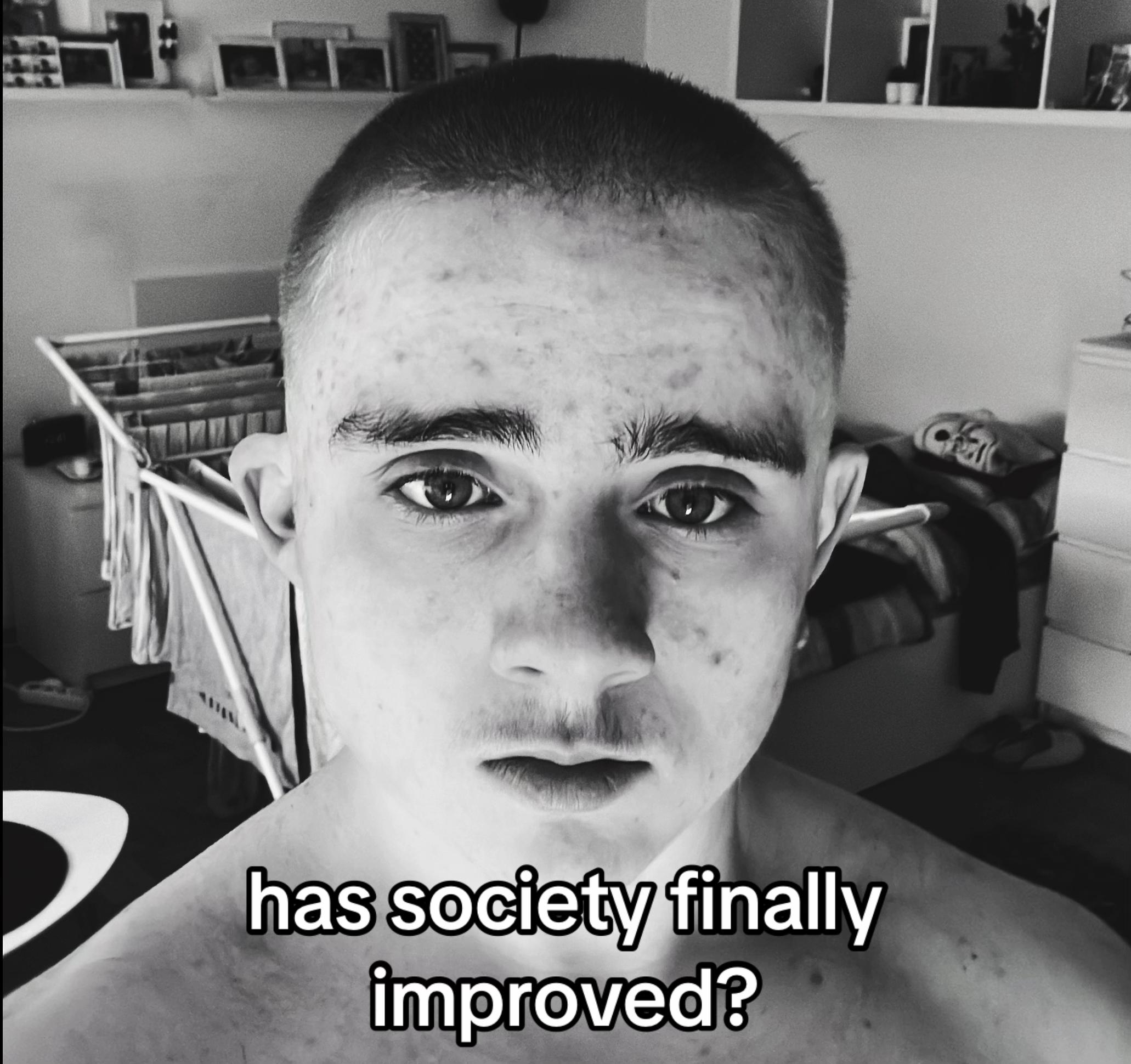 @Finni