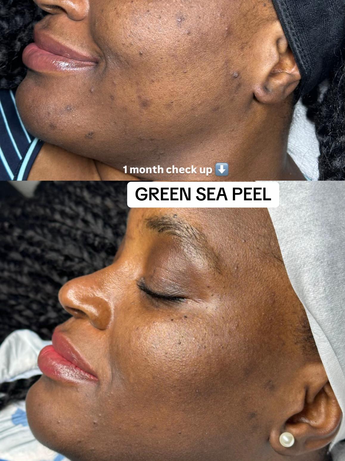 @MONTREAL SKINCARE SPECIALIST