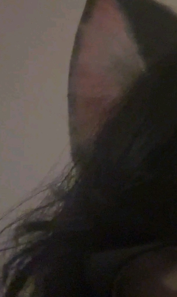 @ace