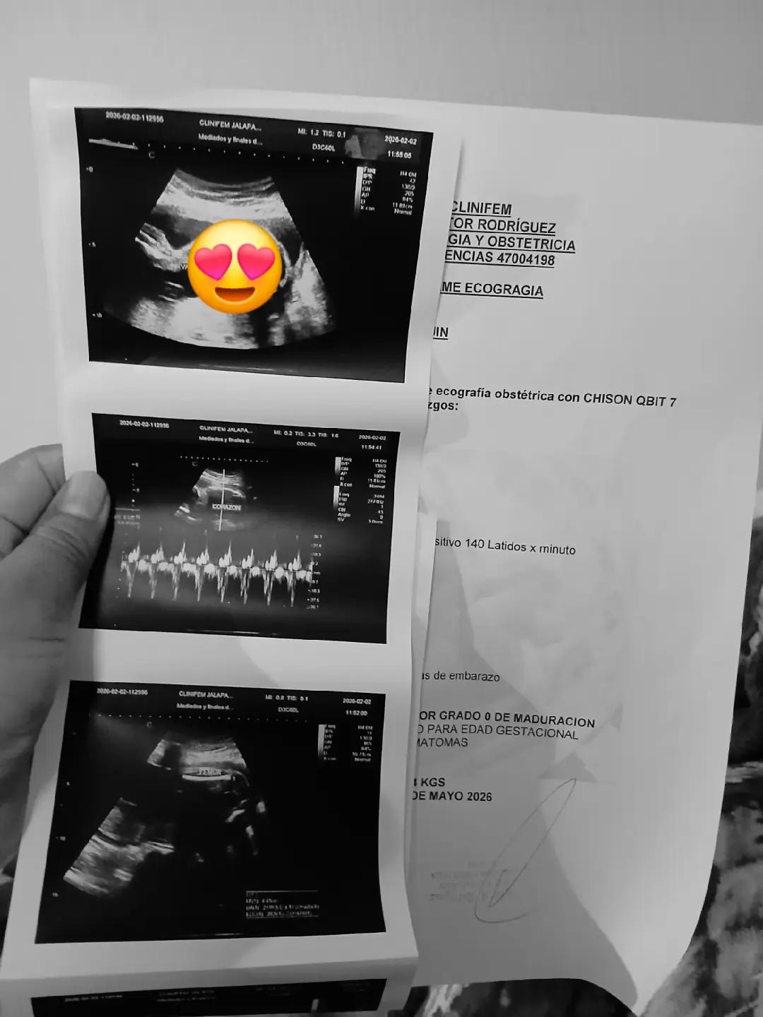 @DE ROLBIN VALENZUELA.❤️