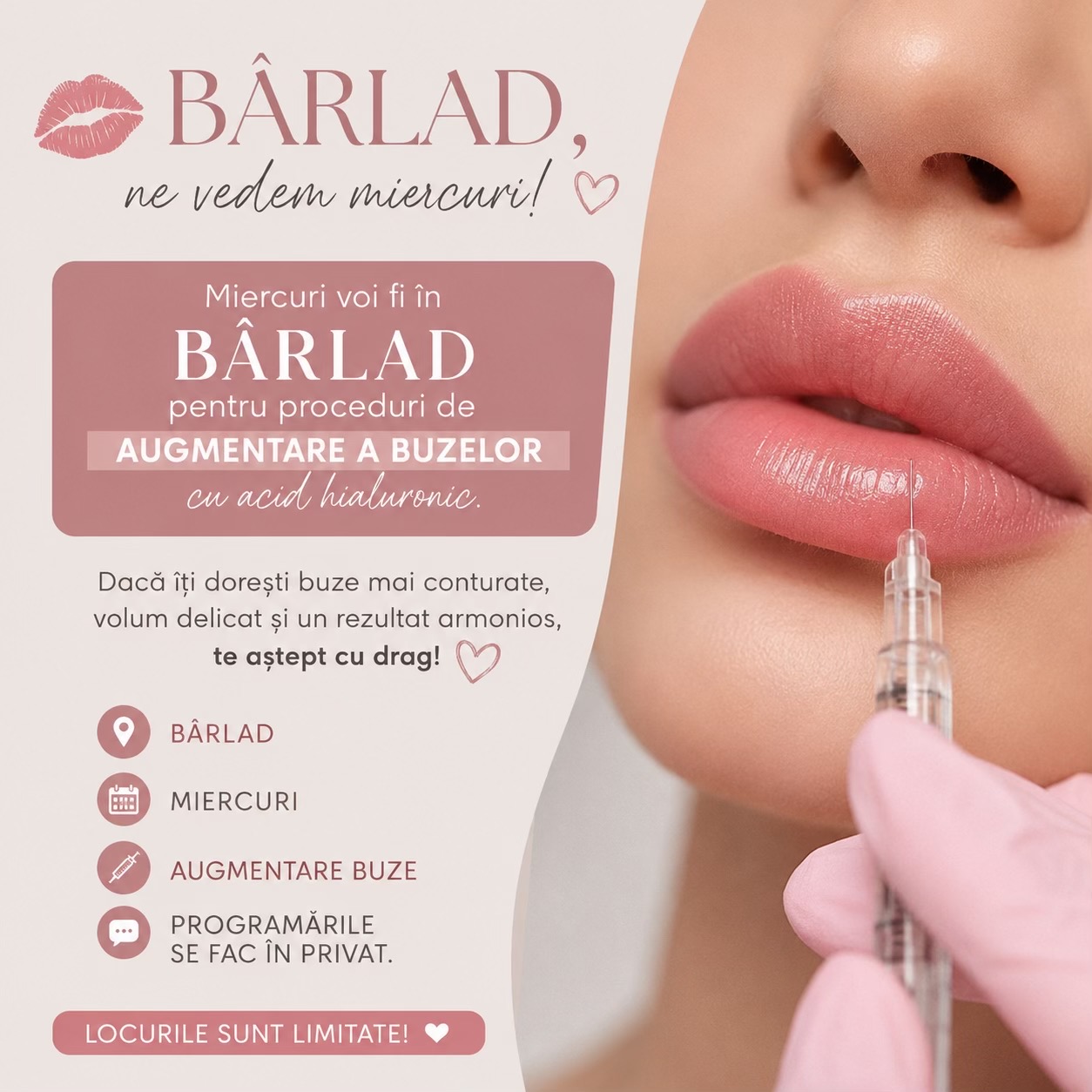 @Academia de Volum Buze 👄