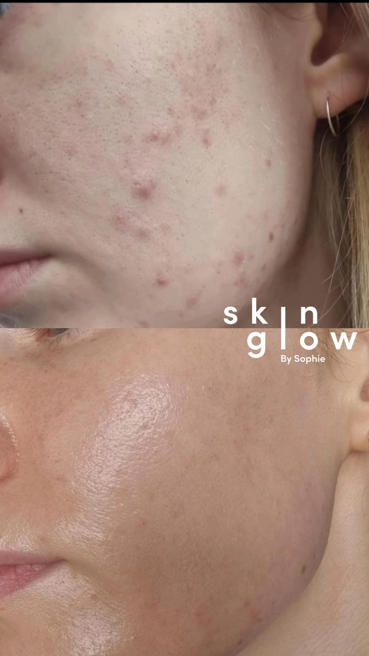 @Skinglowbysophie