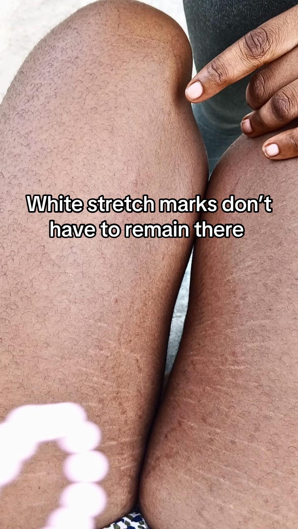 @Radiant skin