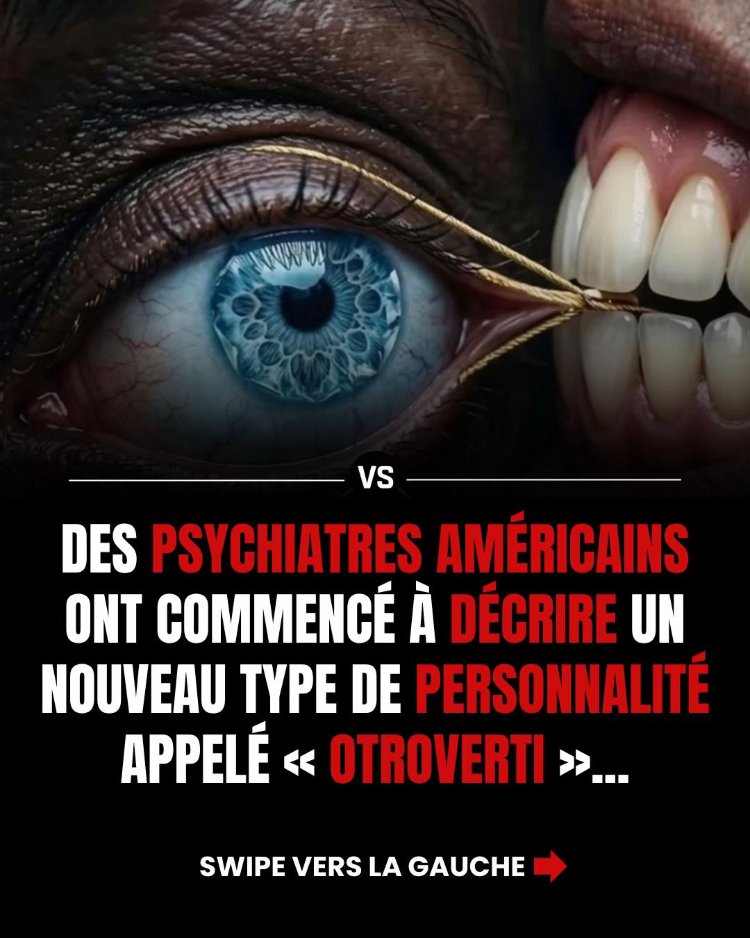 @Vision_succ&egrave;s