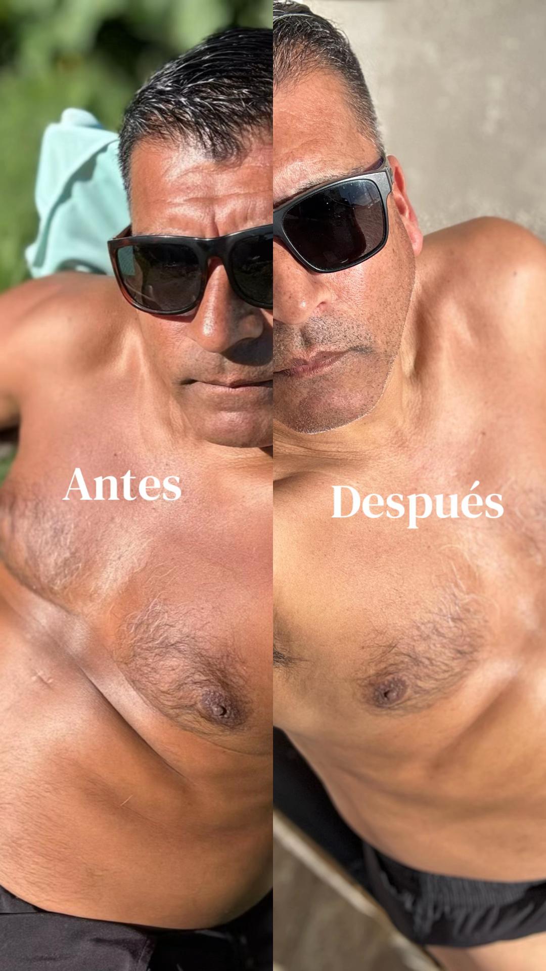 @MANU