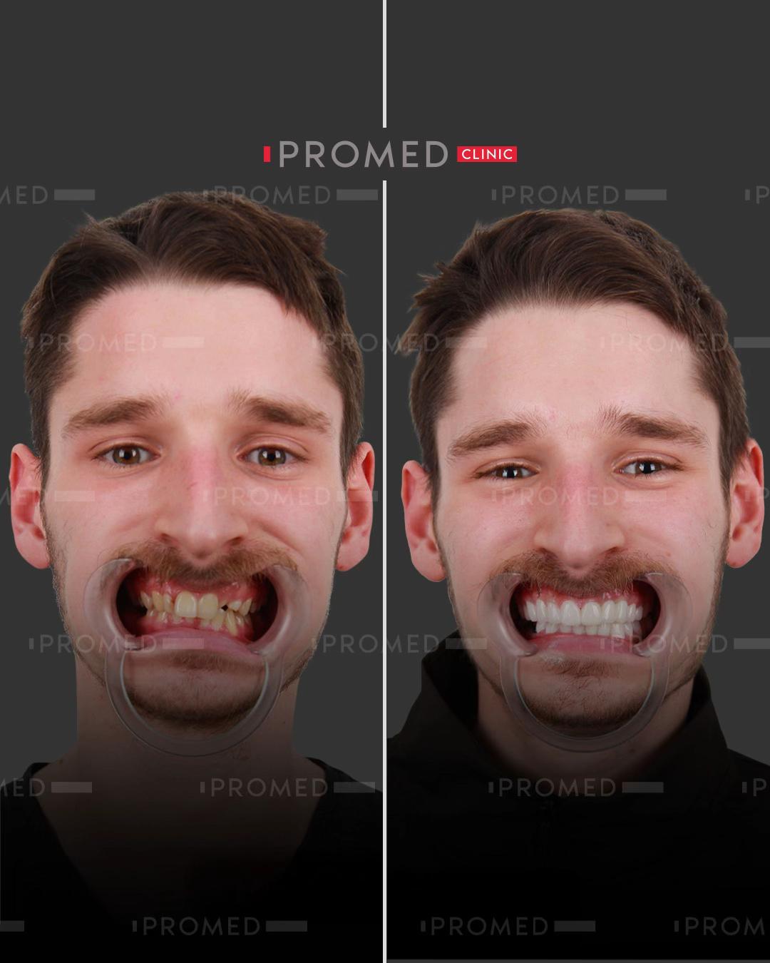@promeddentalclinic