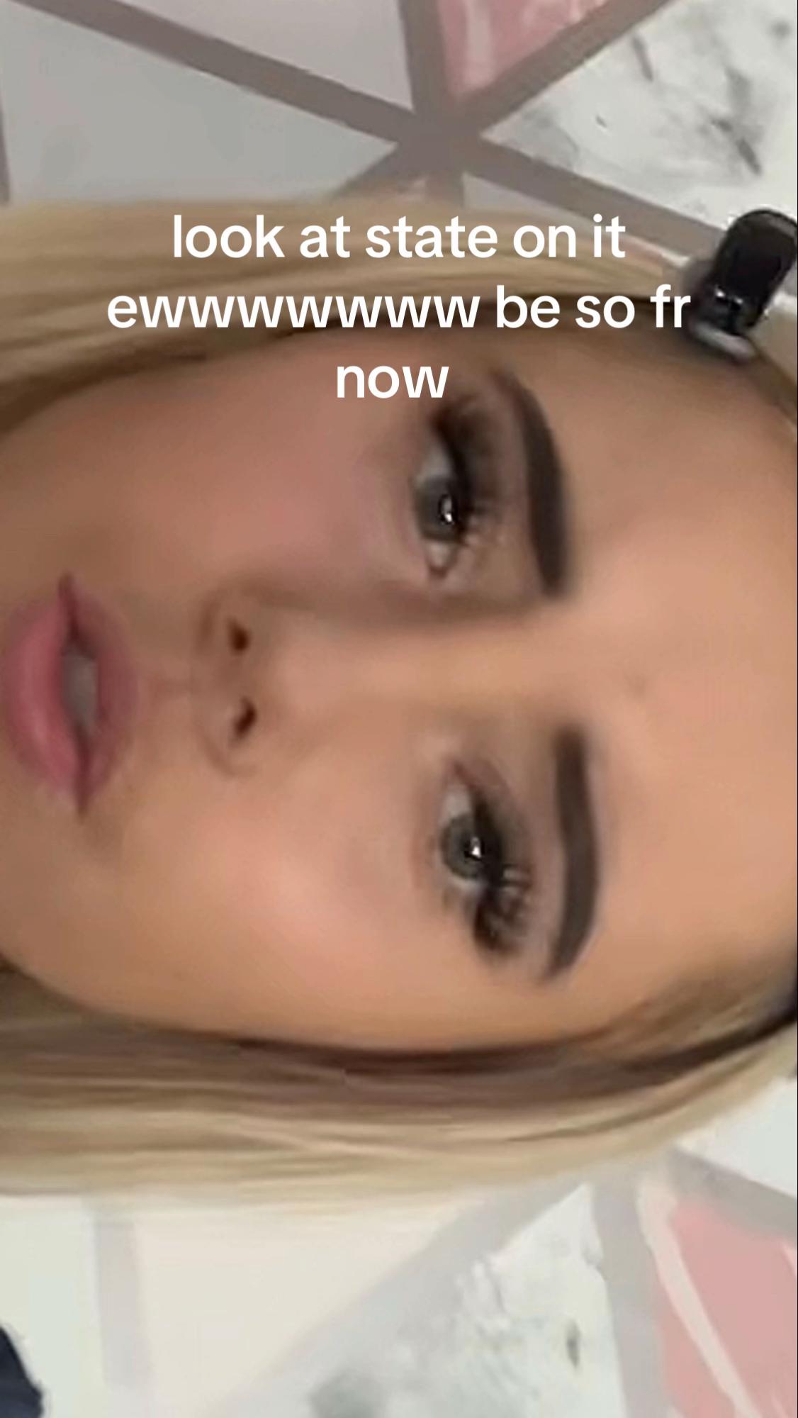 @burnleybaitsss0