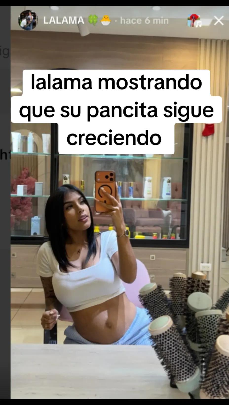 @EnElOjoDelHuracan👁️🐸
