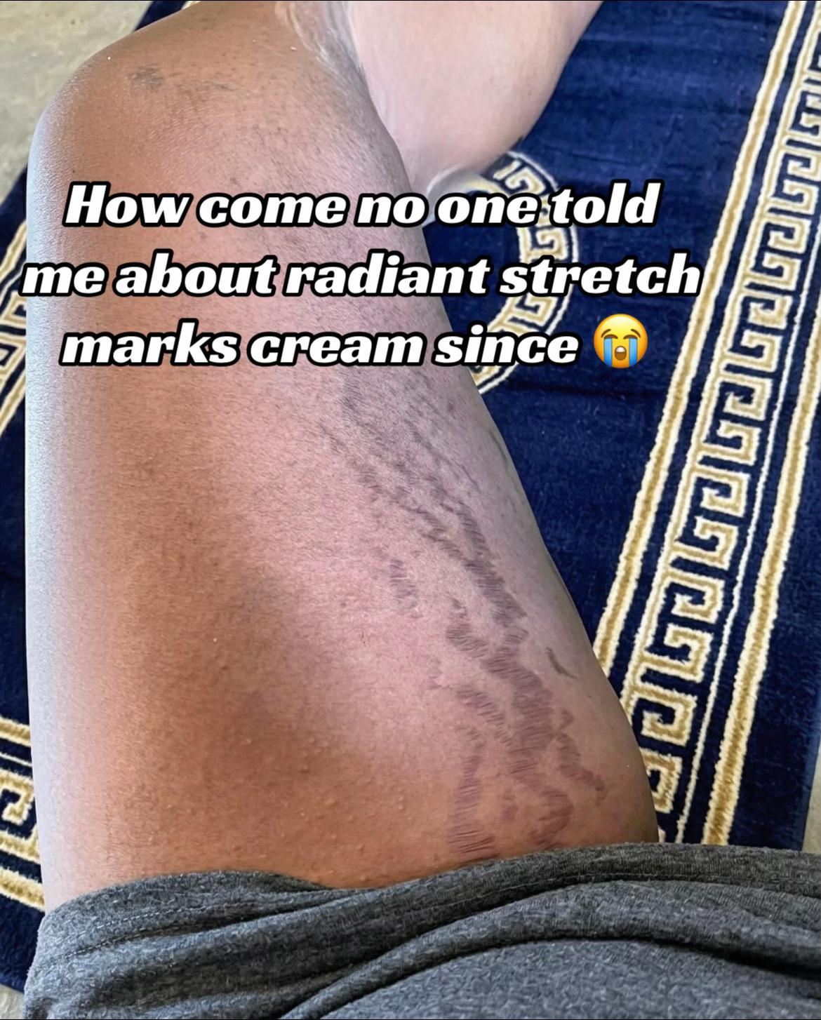 @Radiant skin