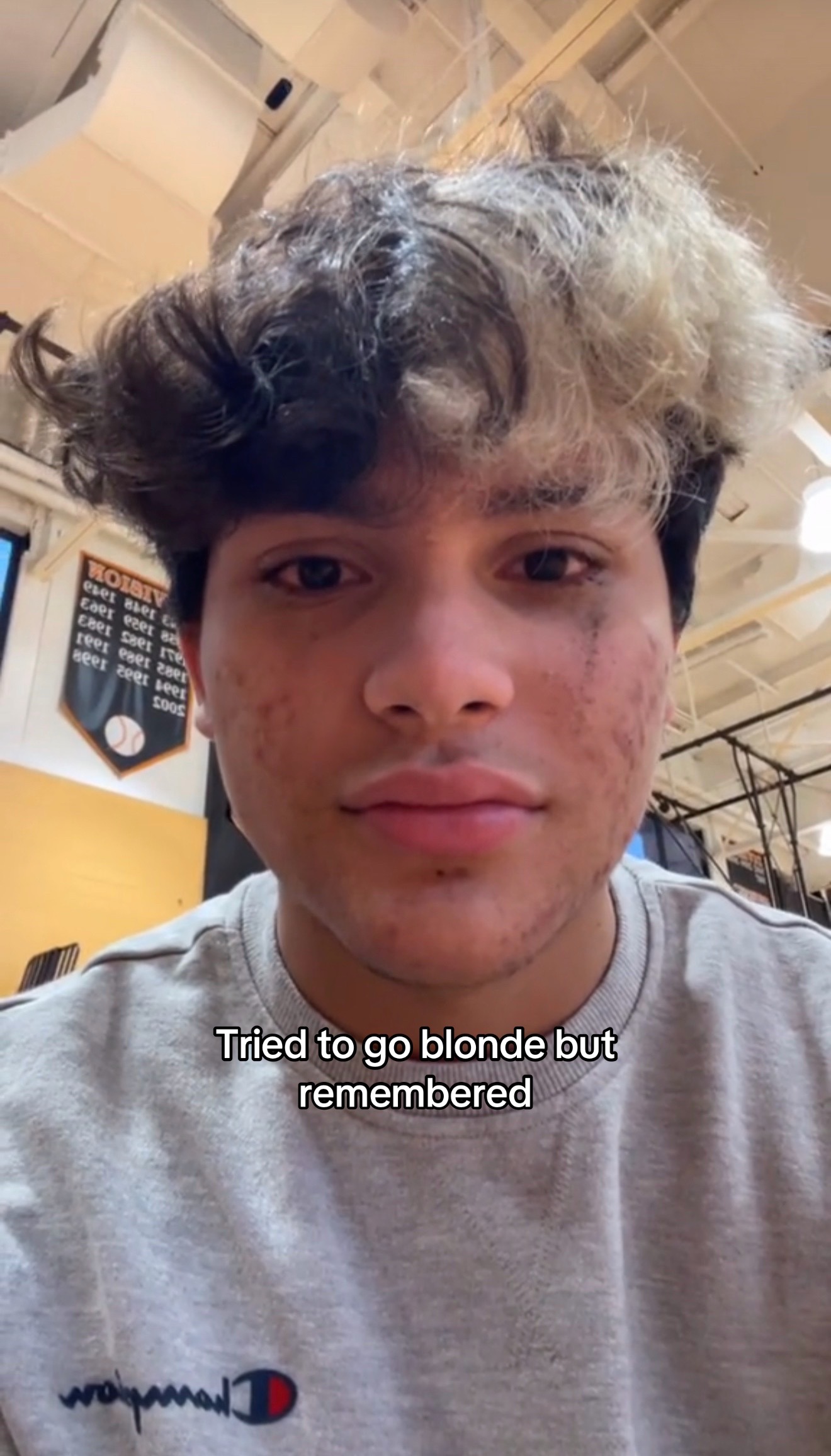 @Lorenzo