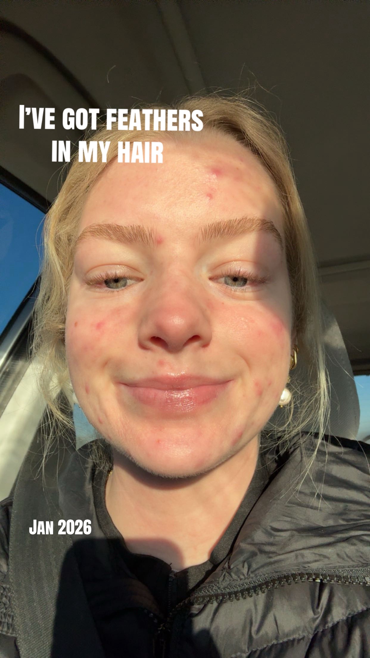 @HOLLYN | CDA 🦷🧚🏼♀️