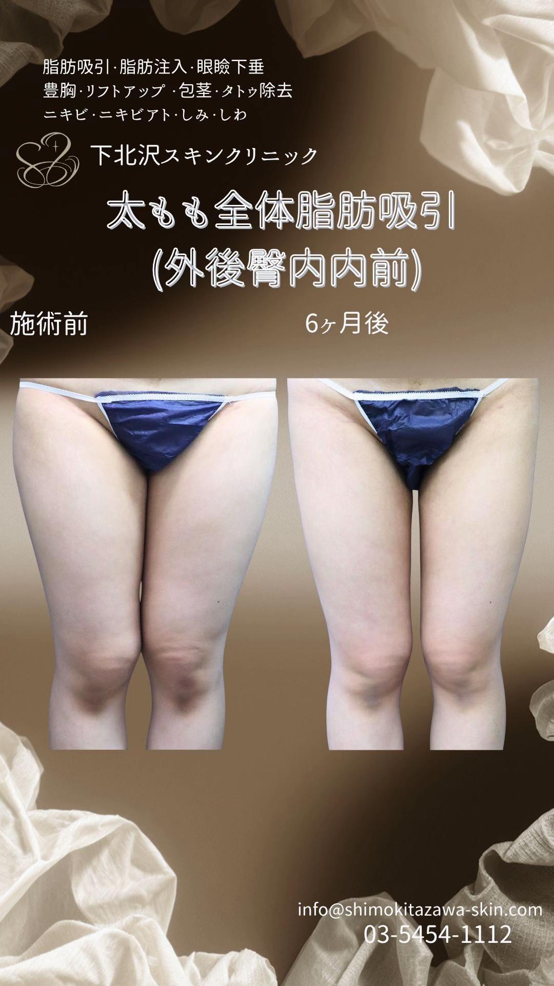@下北沢スキンクリニック院長・こころの美容外科医・保坂宗孝