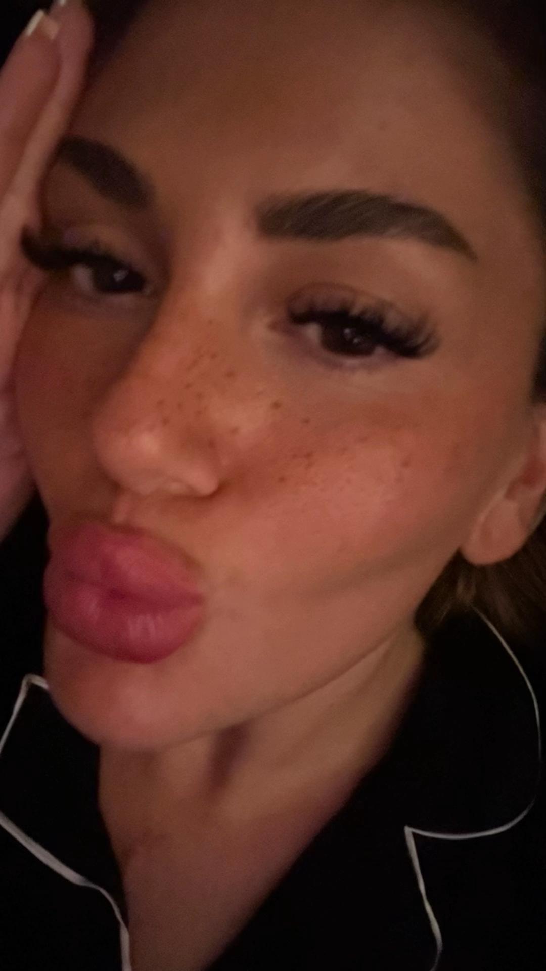 @B.D