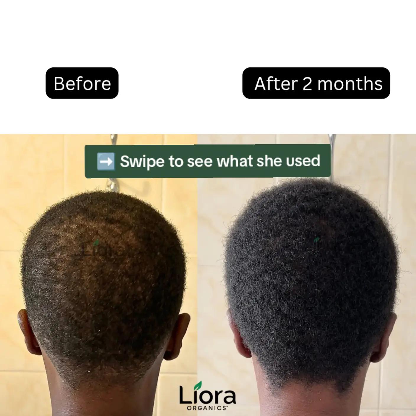 @Liora Organics™