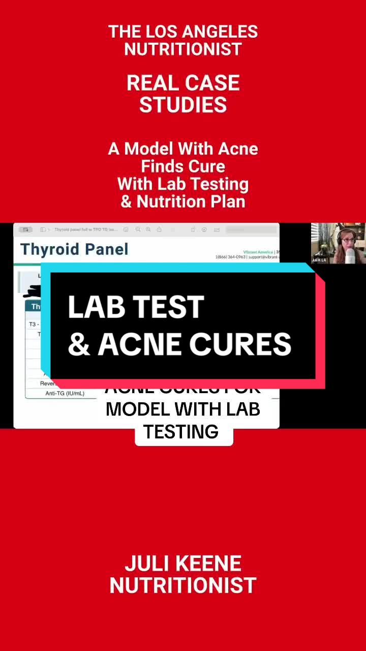 @losangelesnutritionist