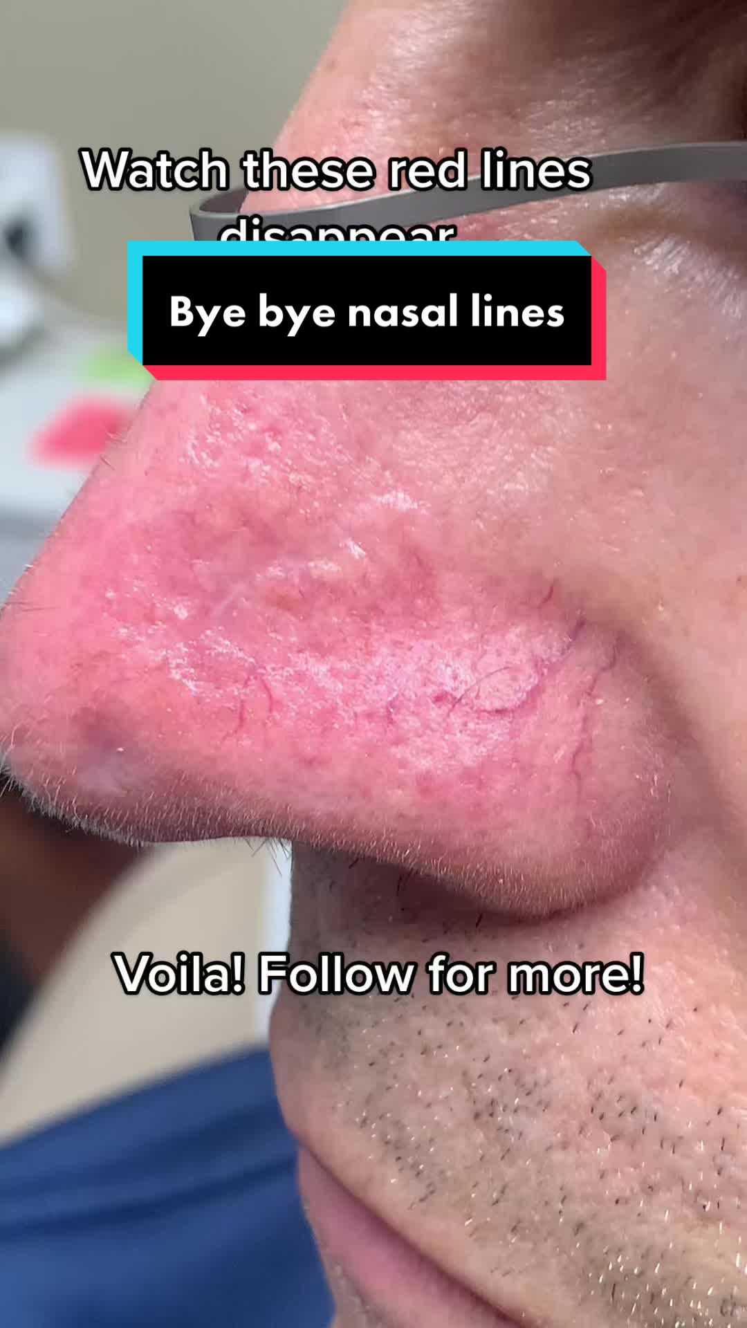@Dr. Leela A | Dermatologist