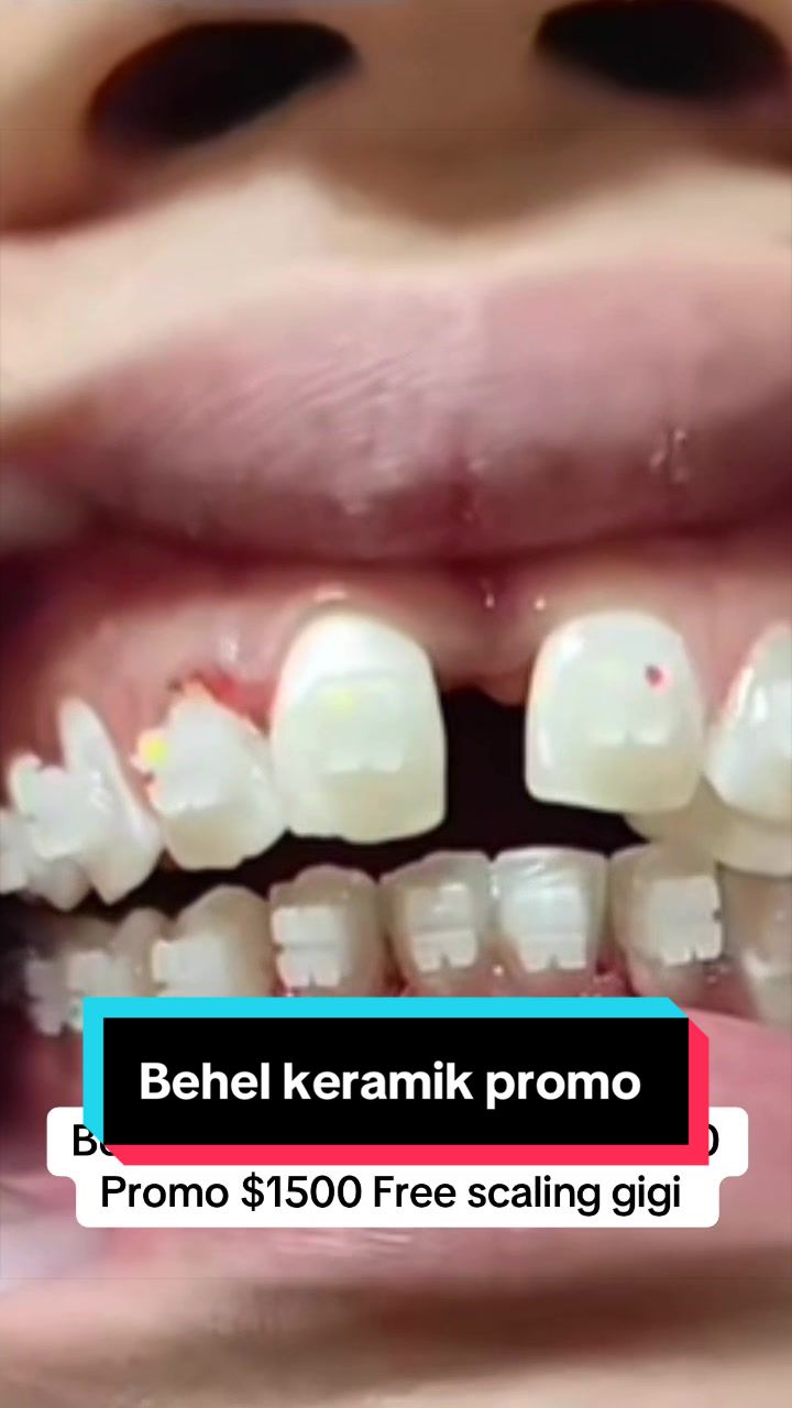 @mbak-Paijem