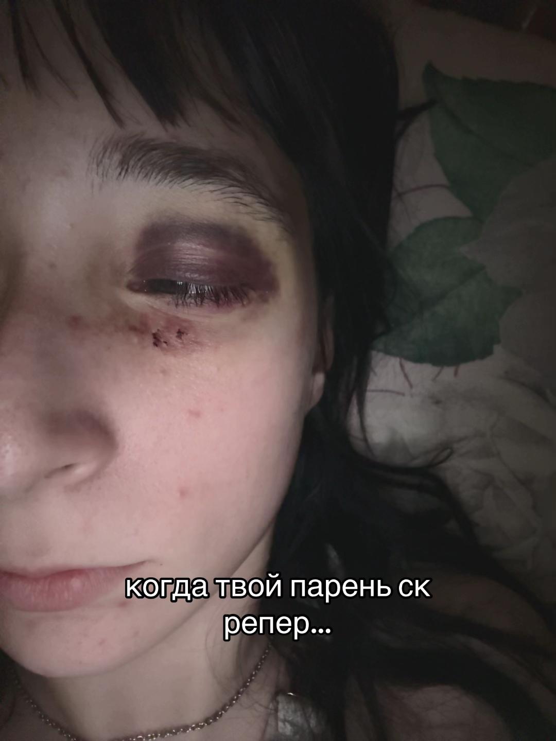 @numfetka