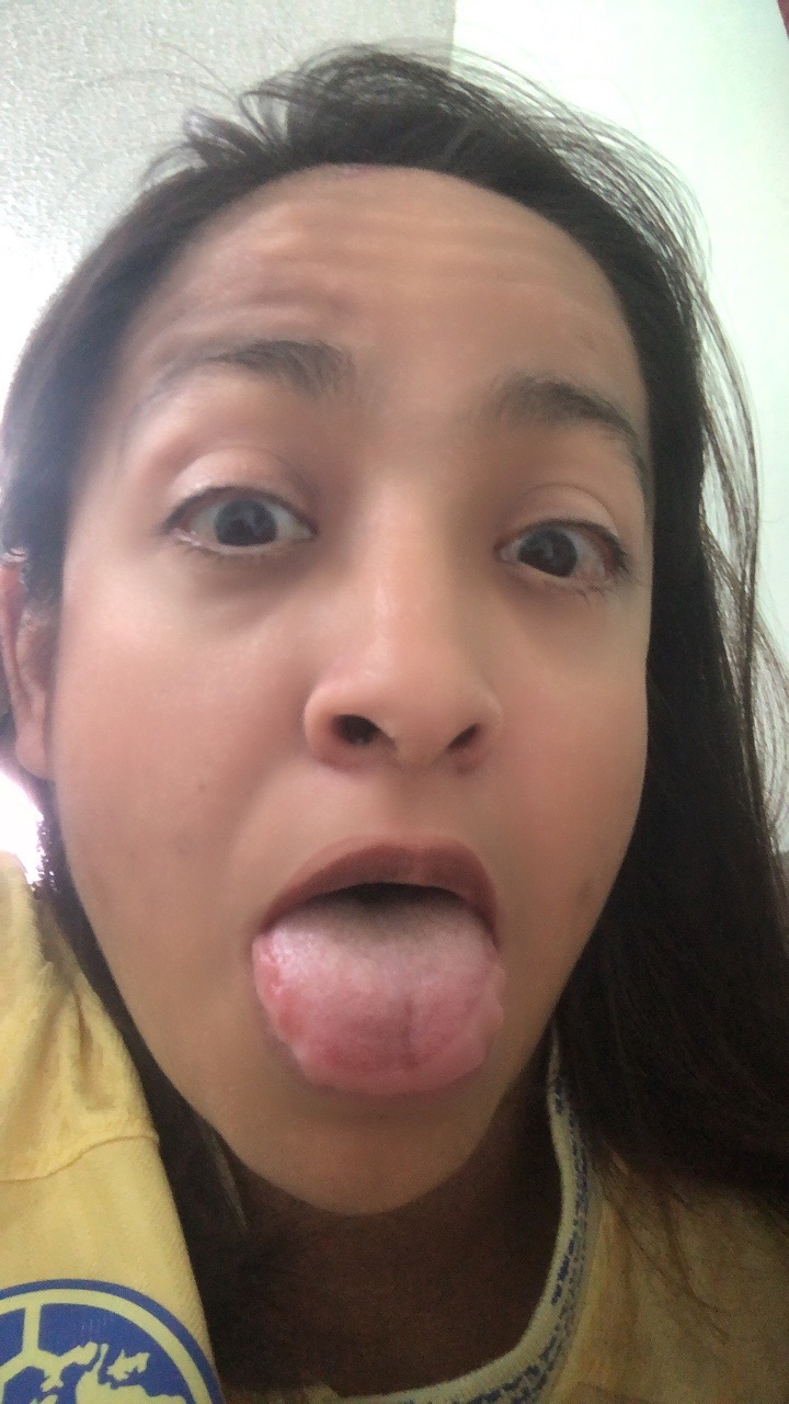 @๐โ๏ธ๐ฆ
๐ฆEdith ๐ฒ๐ฝ๐ณ๏ธ๐37