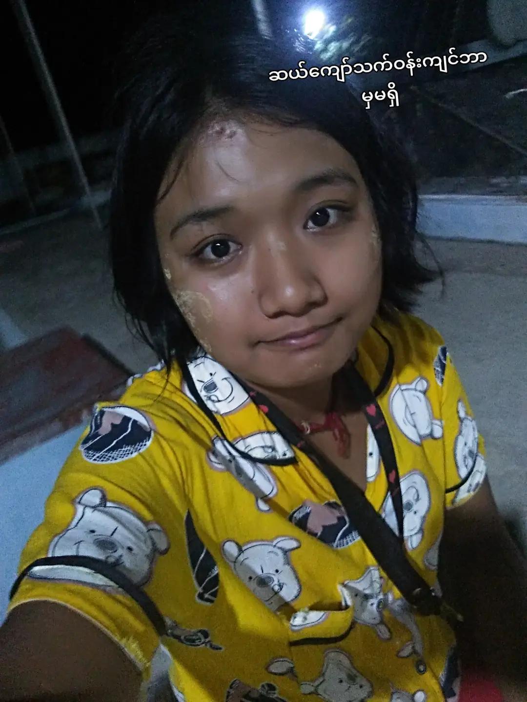 @Ei Phyo Aungđ˛đ˛đ˛đ˛đ˛đ˛