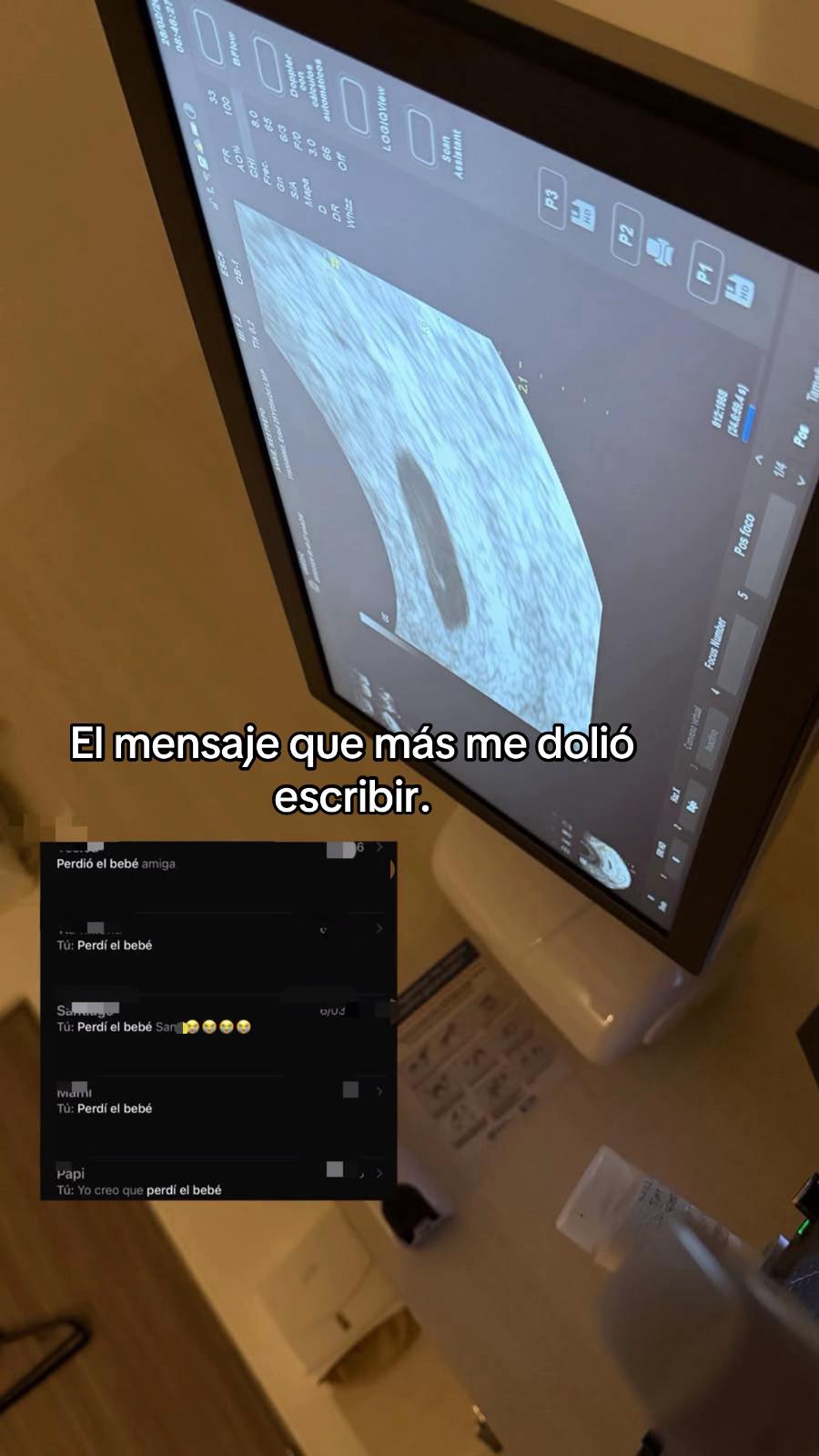 @Angie