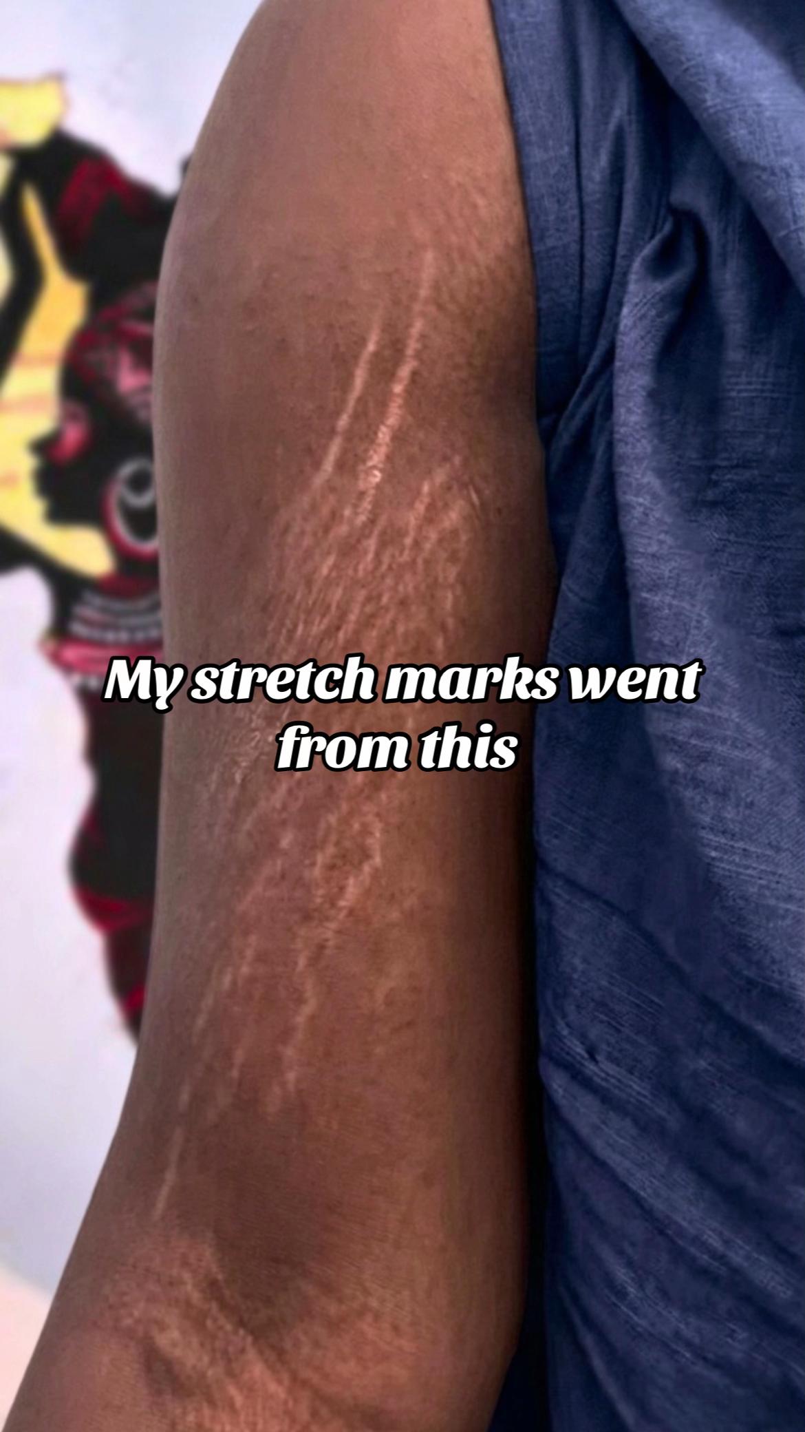 @Radiant skin