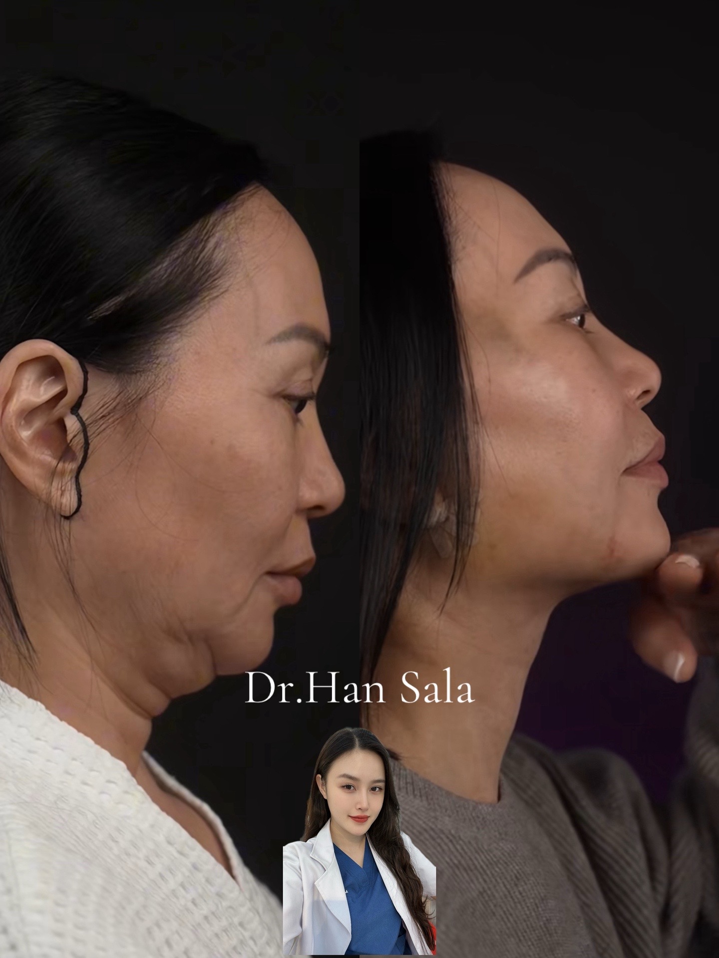 @Dr.Han Sala Beauty