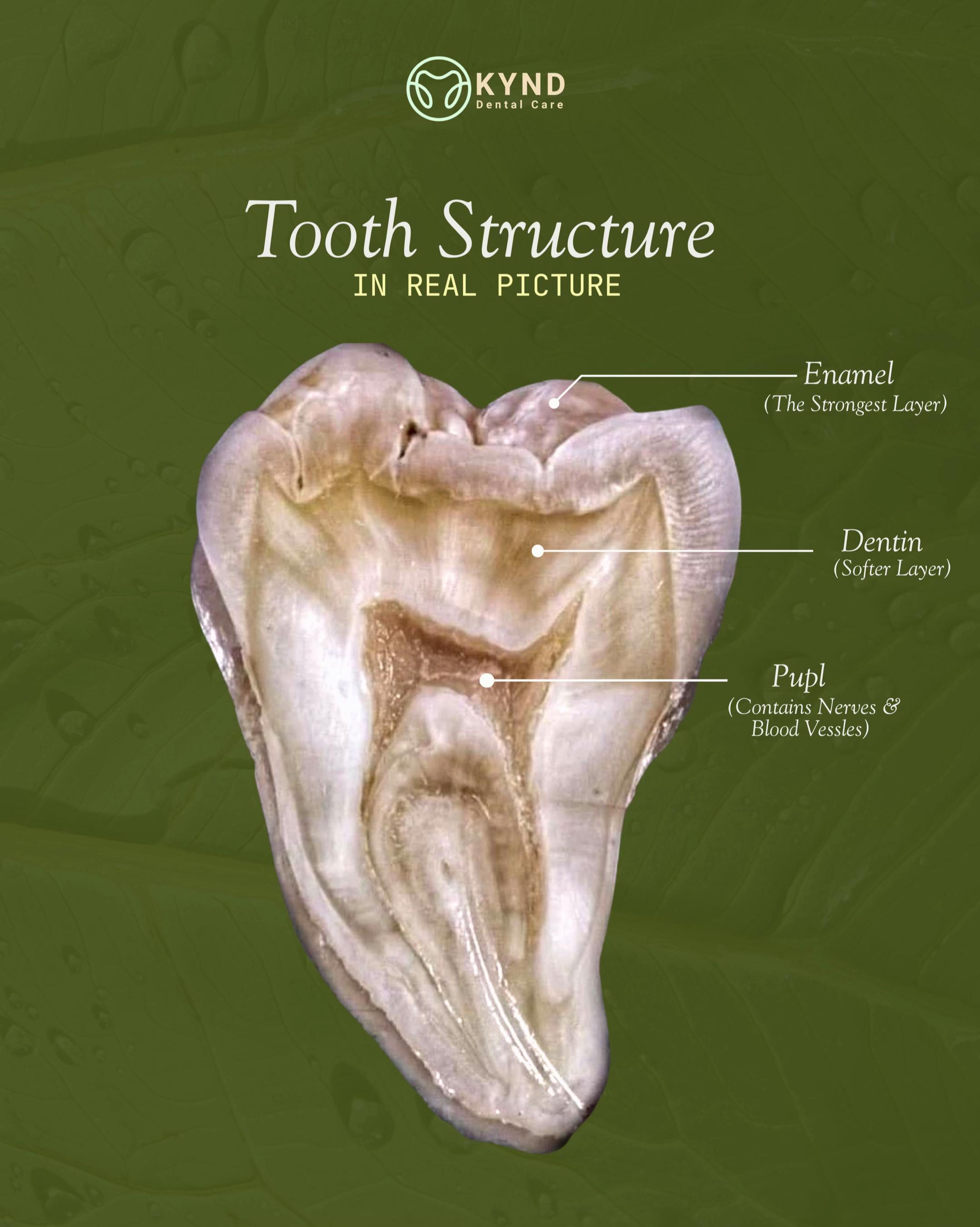 @KYND Dental Care |Dentist BALI