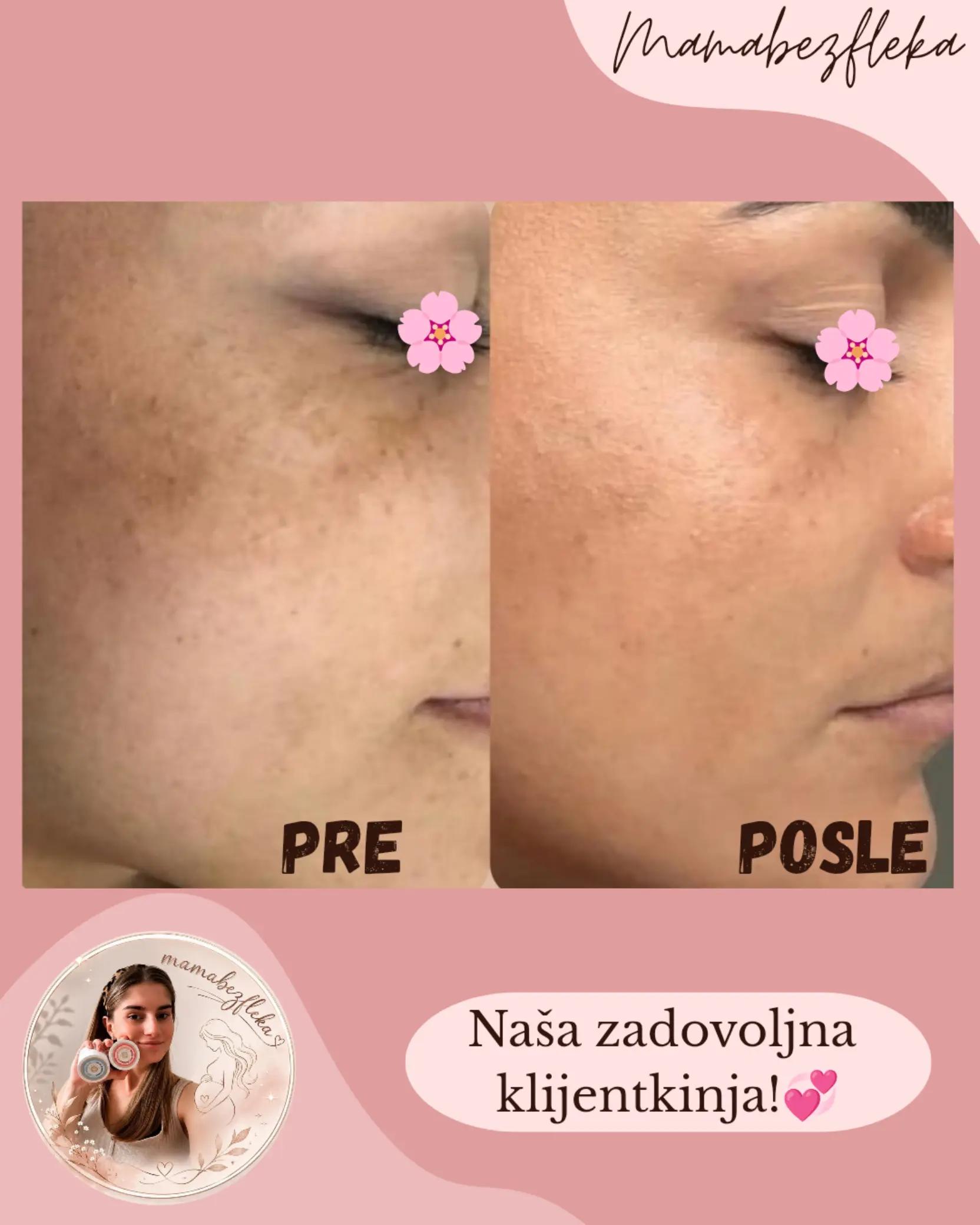 @Mama bez fleka