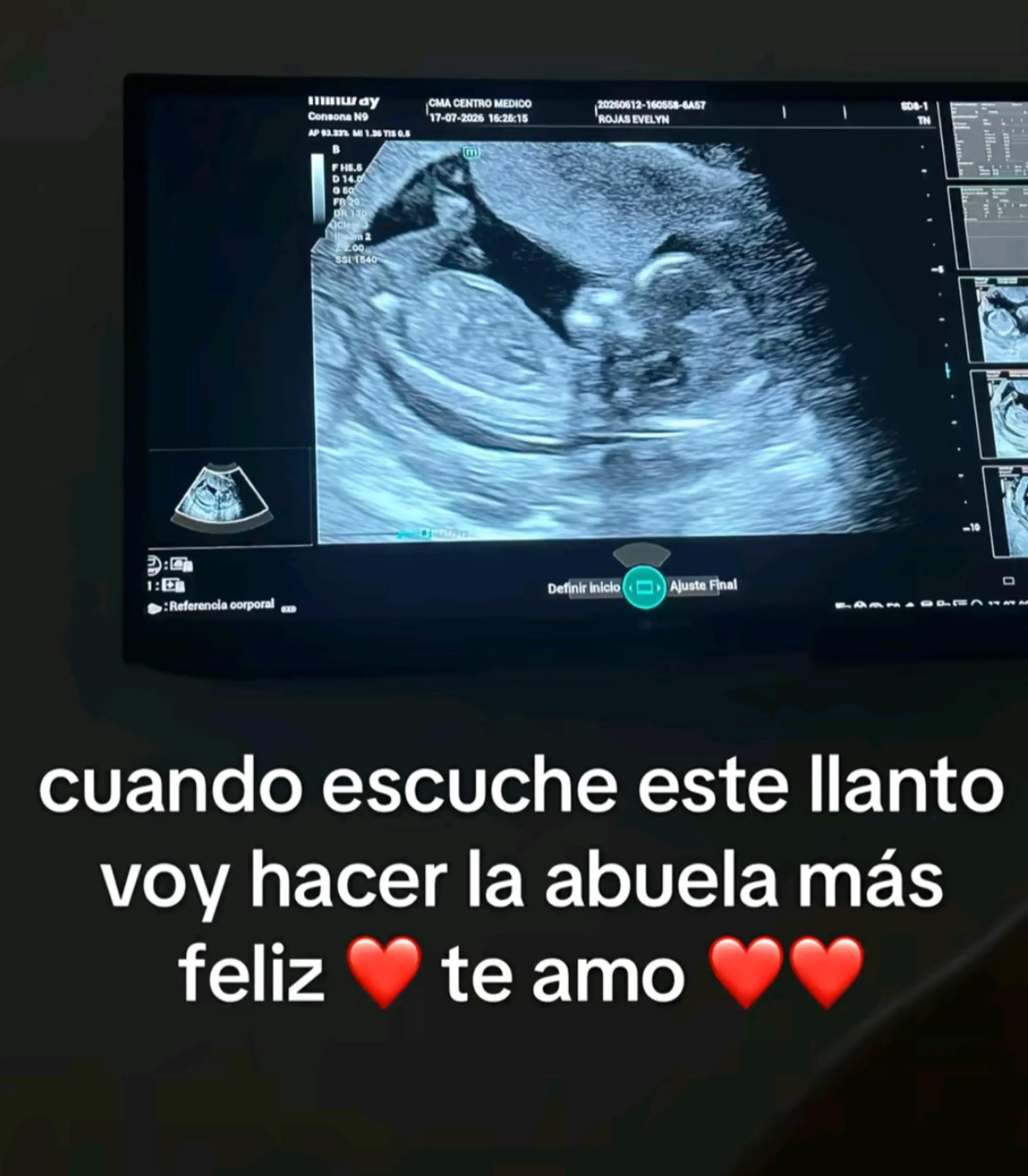 @ELI