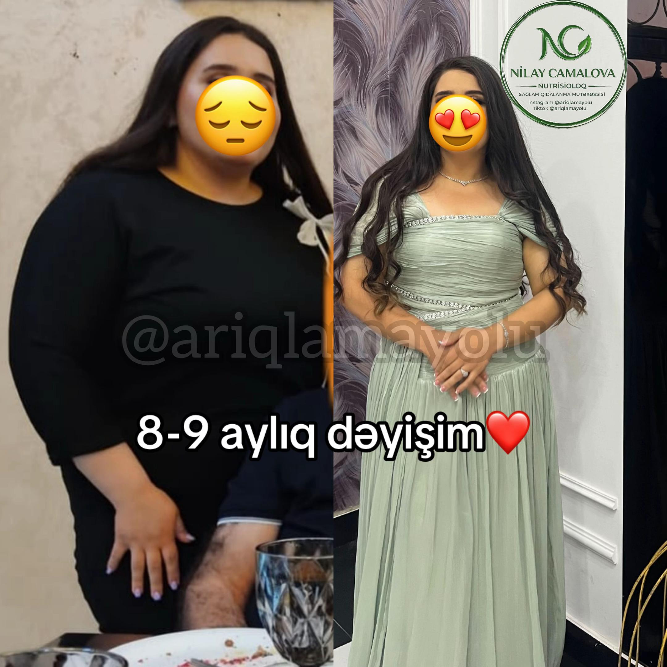 @Nutrisioloq Nilay Camalova 🥑
