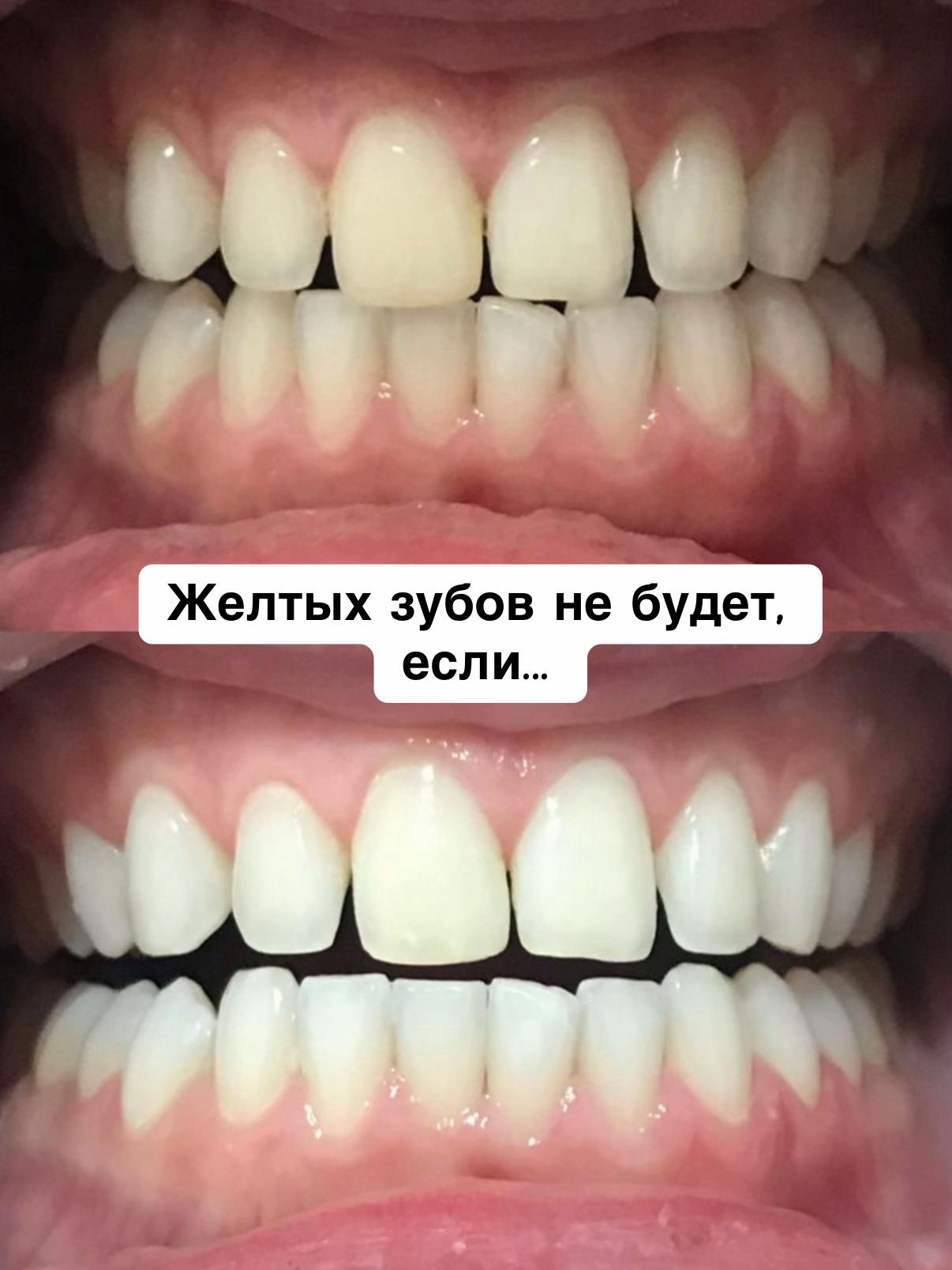 @iworyy_notes