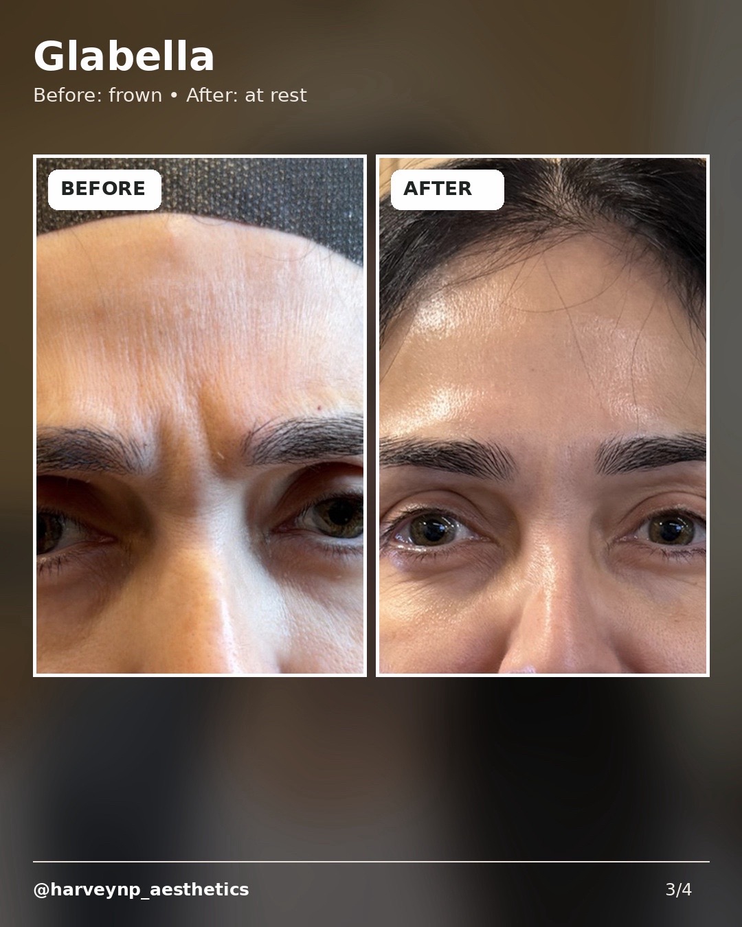@HarveyAesthetics_NP