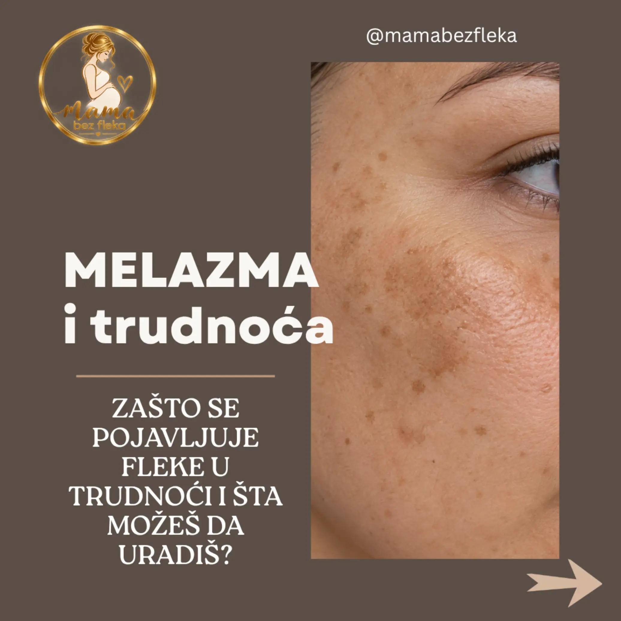 @Mama bez fleka