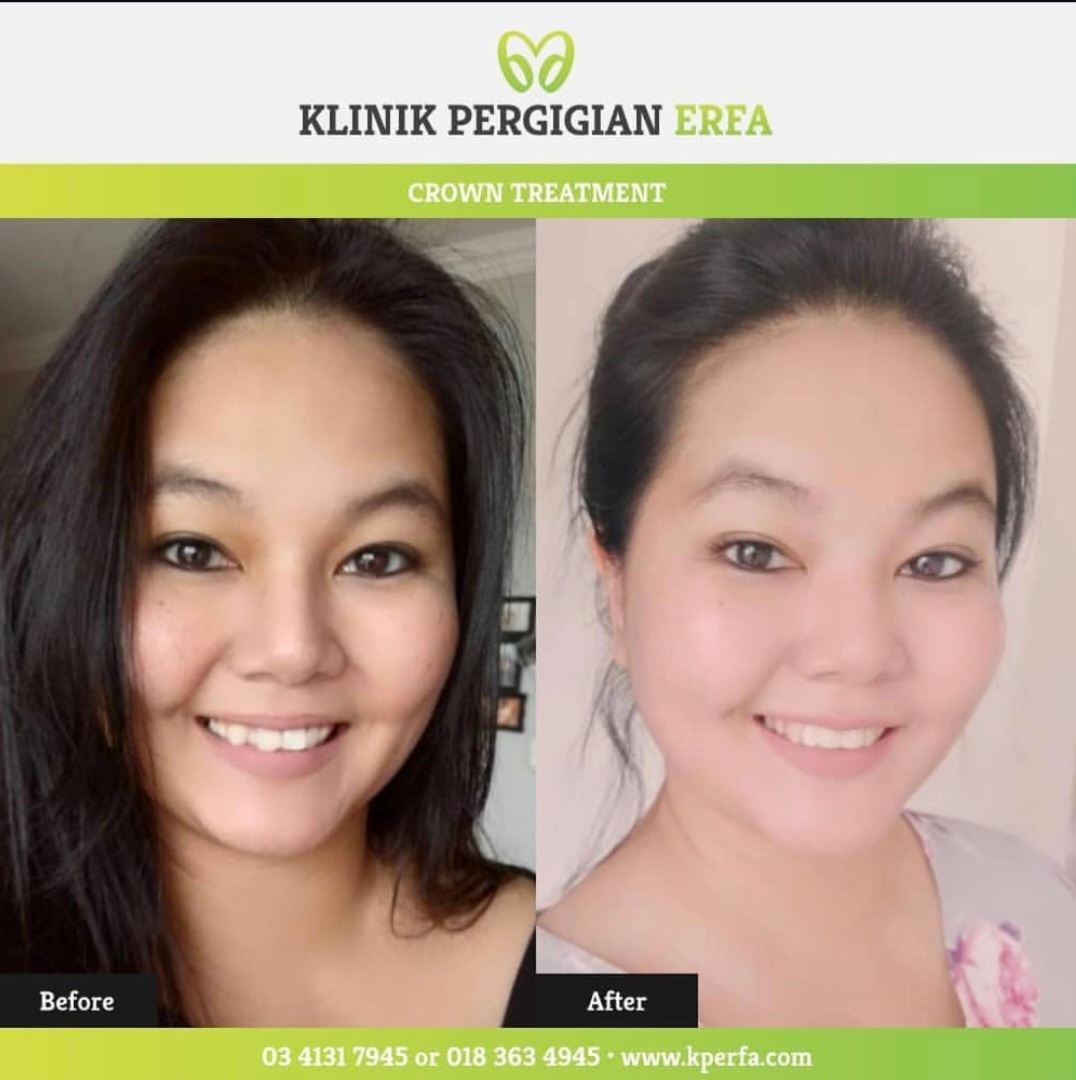 @Klinik Pergigian Erfa