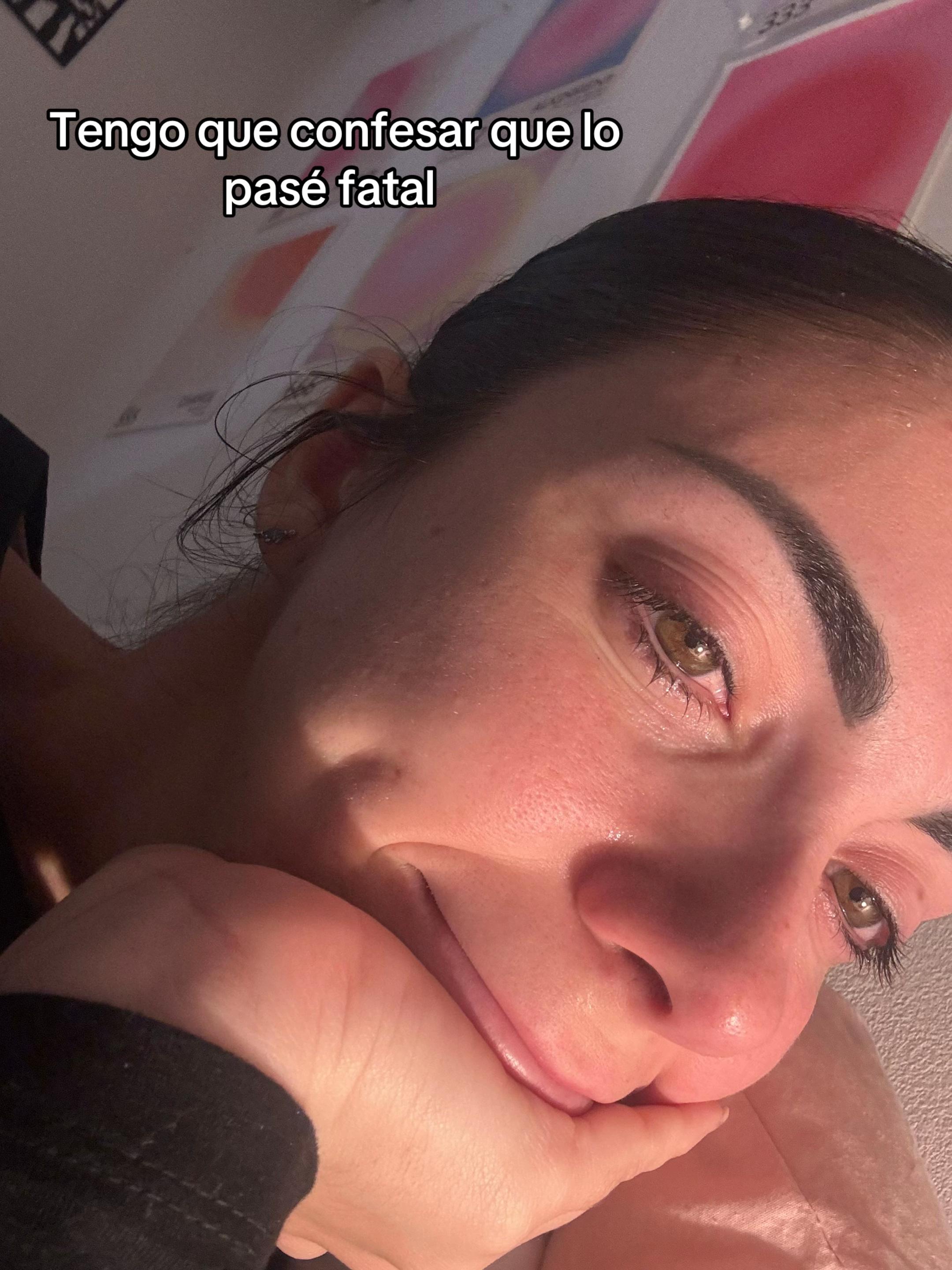 @Albaax