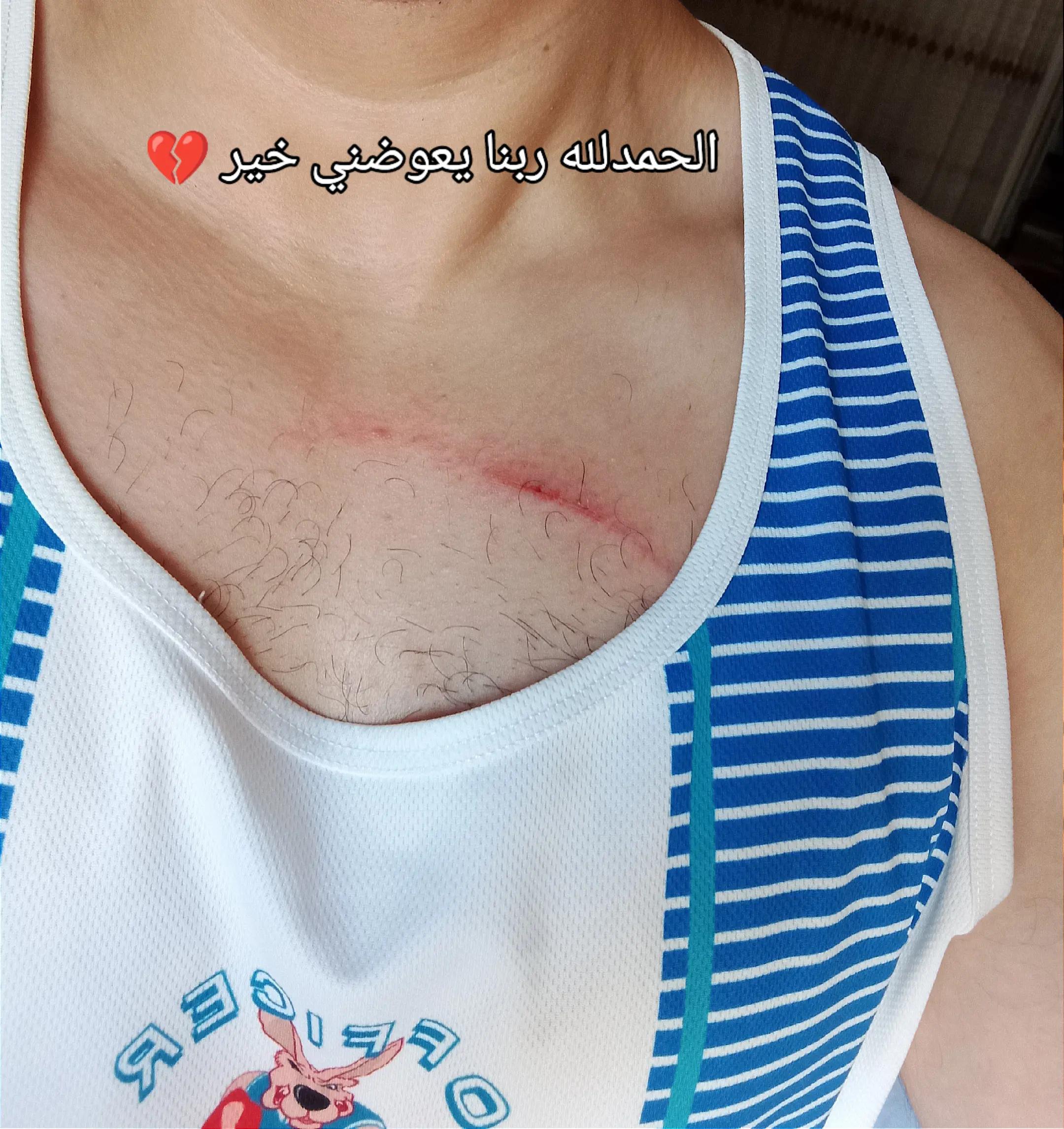 @Ahmed ashraf ๐ฆ