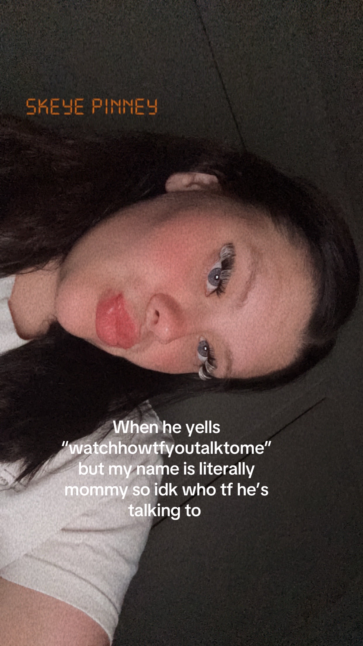 @Skeye Leigh