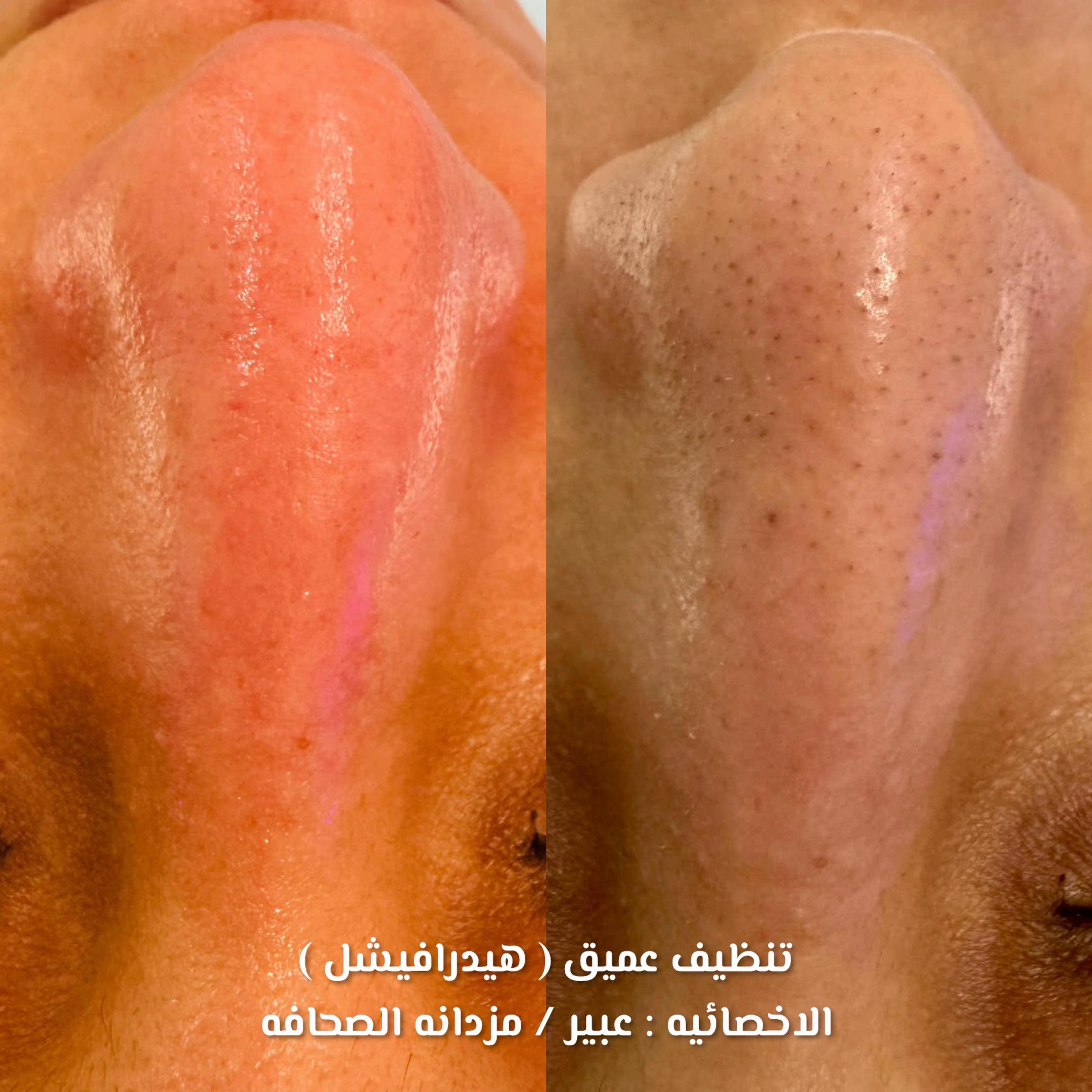 @مركز مزدانه 1 ( فرع الصحافه )