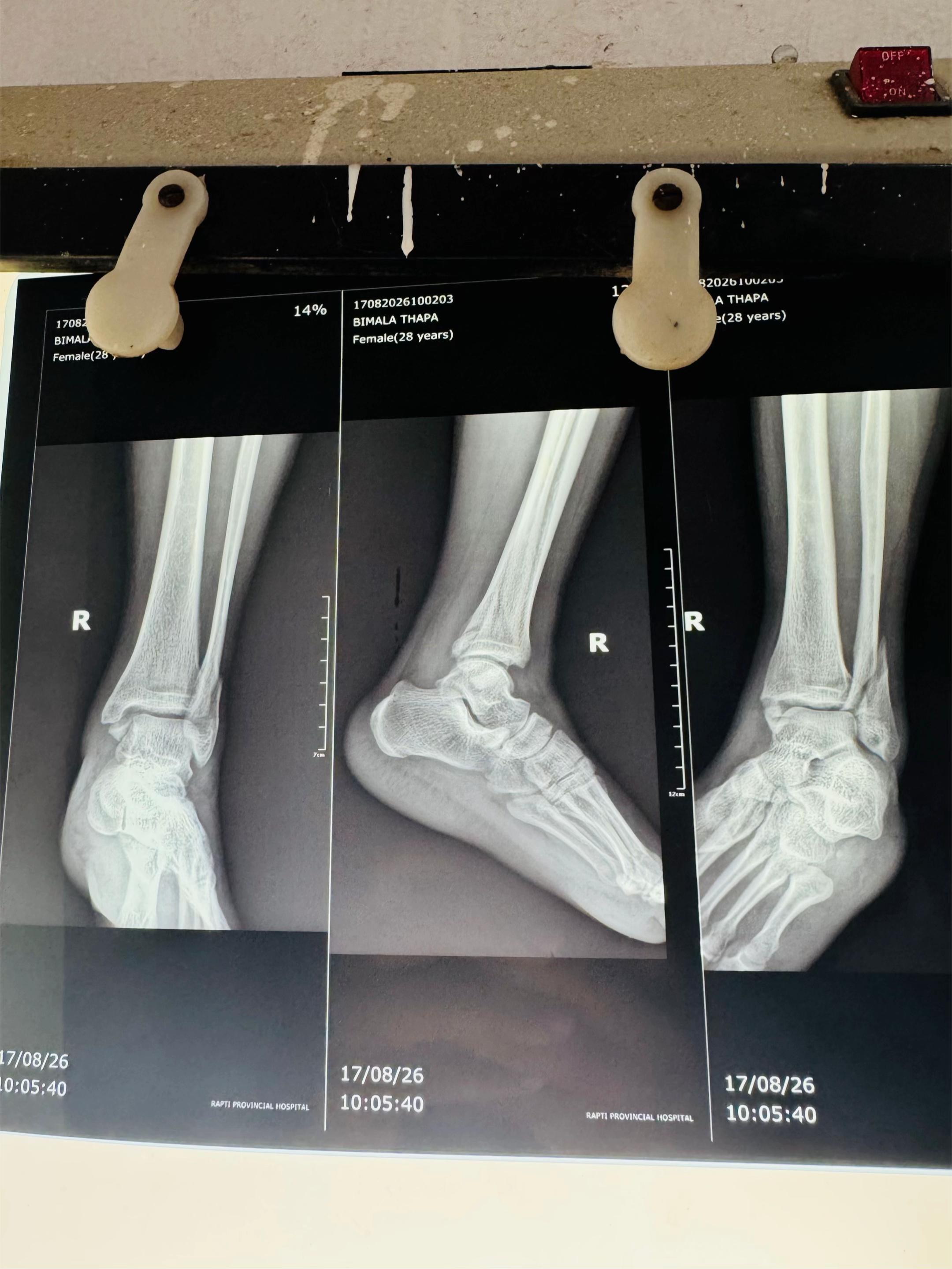 @Dr.Sanjay Gautam,Orthopedics🦴