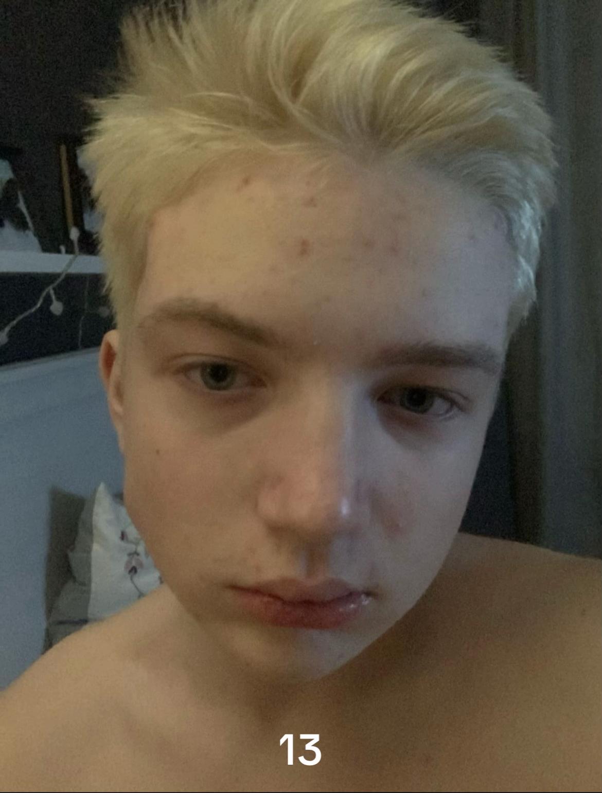 @byfor3very0ung
