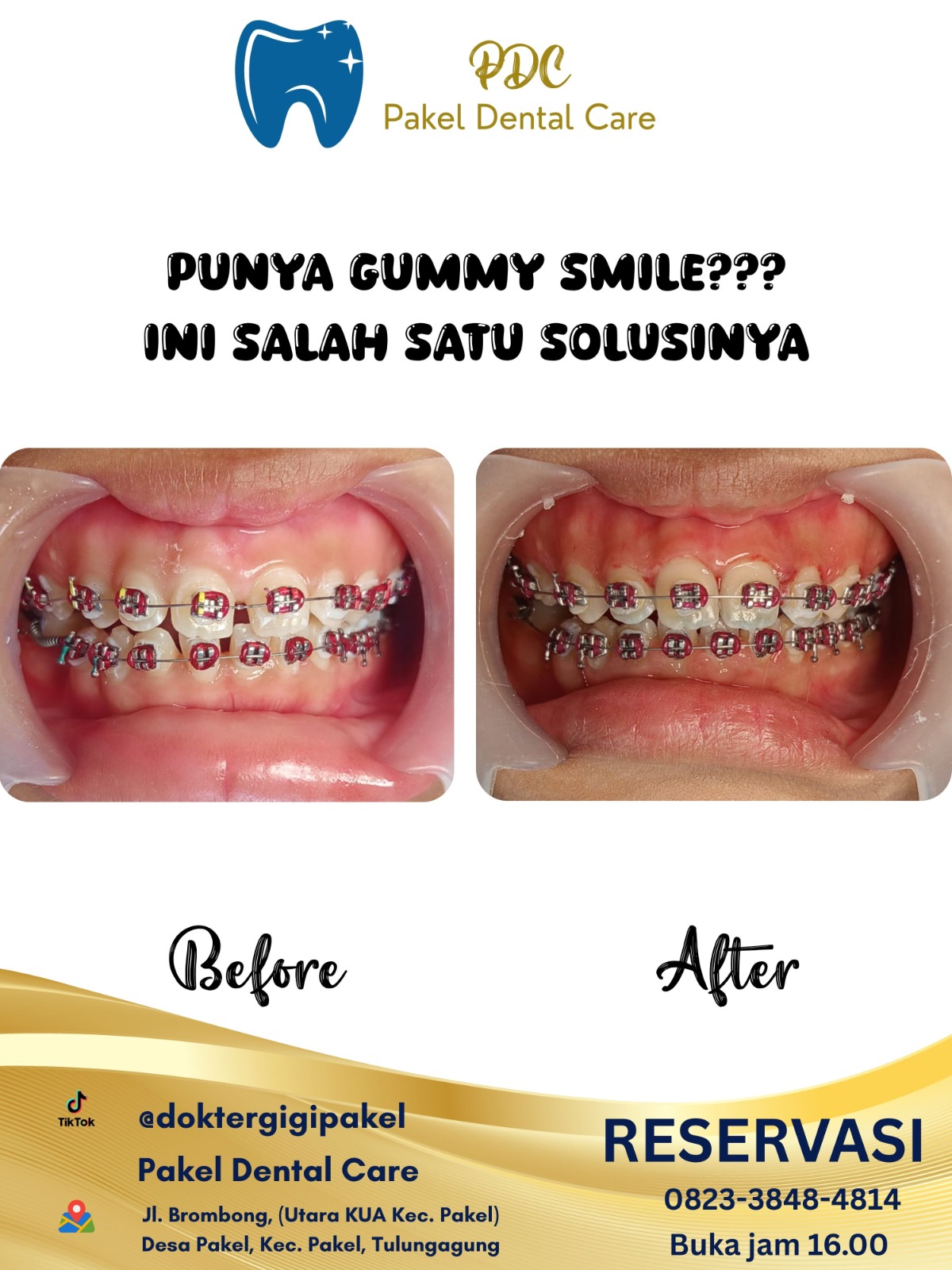 @Pakeldentalcare