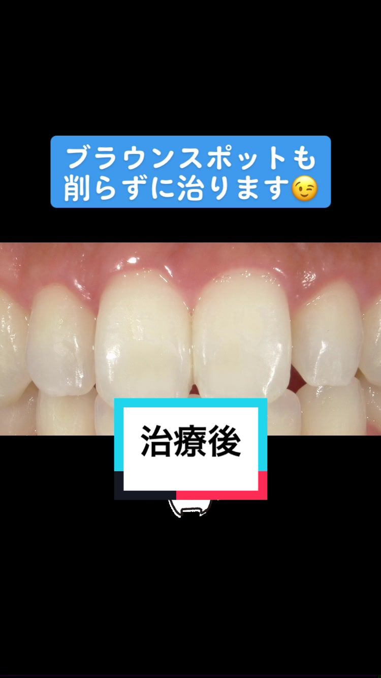 @inouedental tokyo
