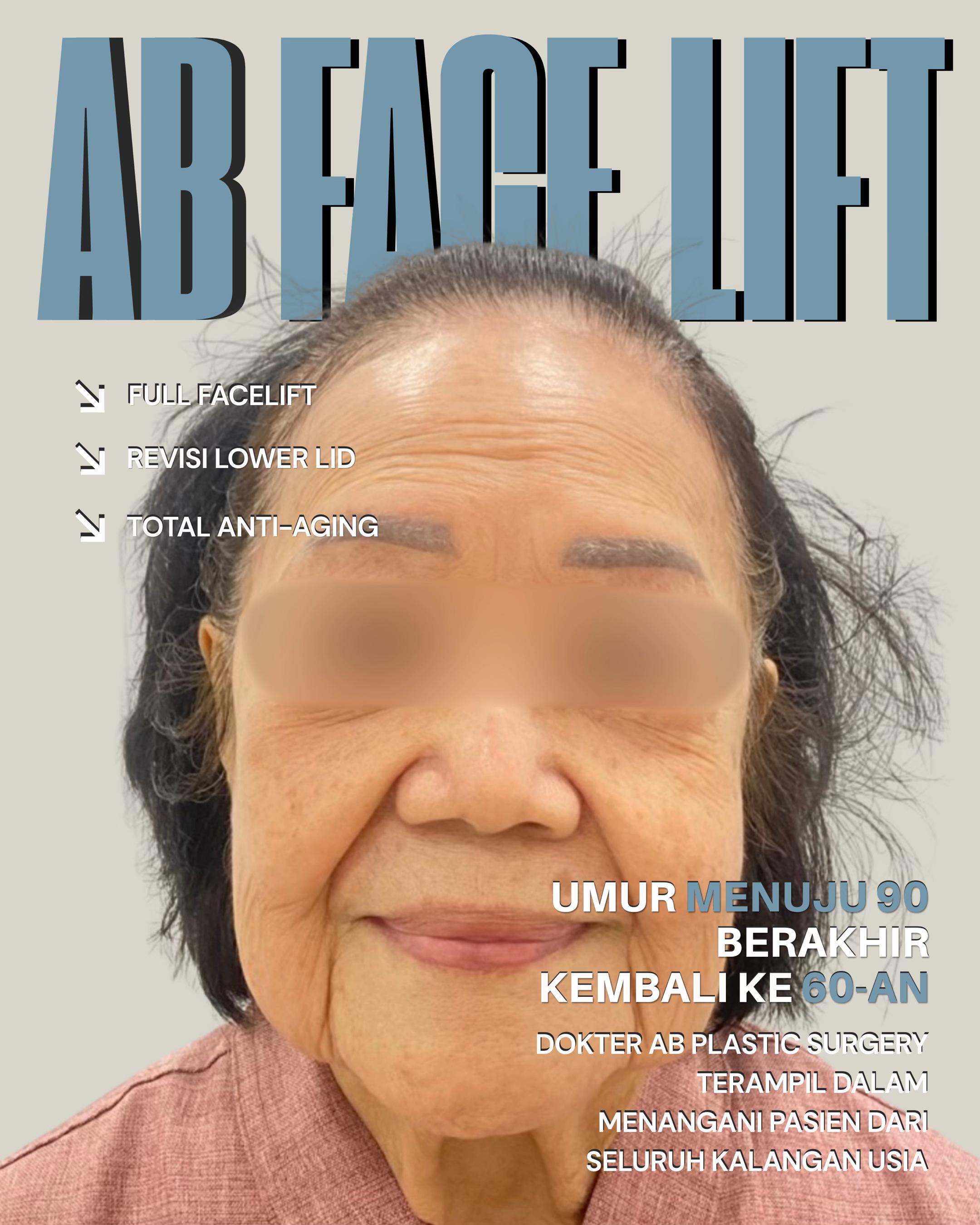 @ABPS Indonesia Official
