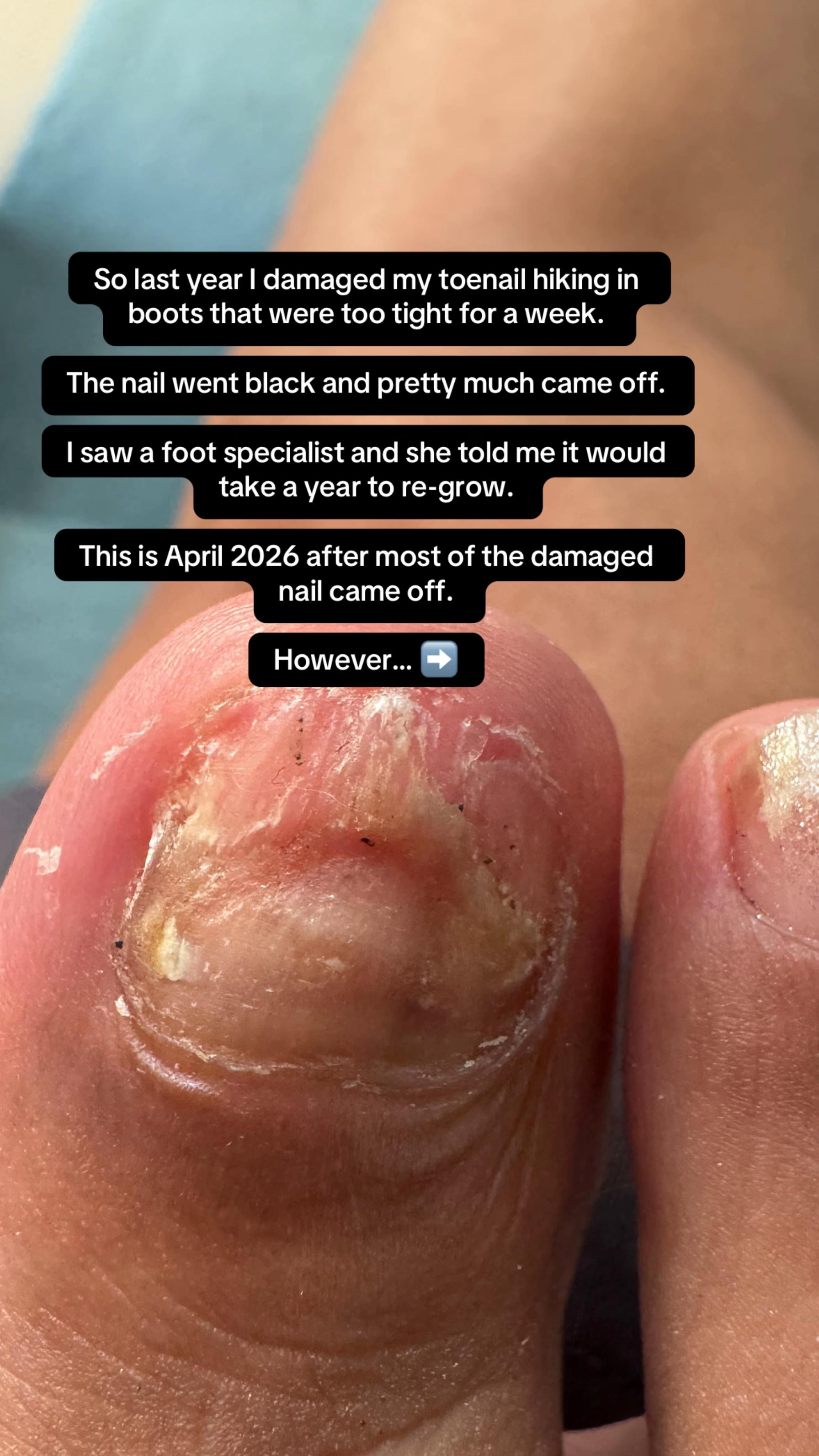 @Emily 50+ skincare