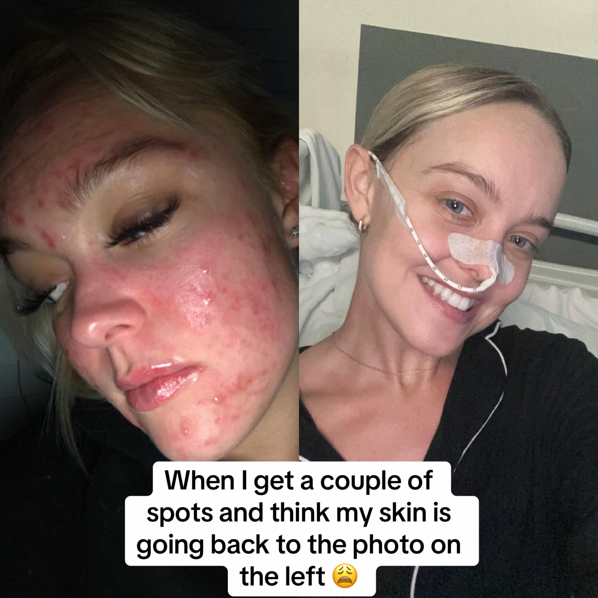 @Soph | IBD | POTS | EDS & co🦓