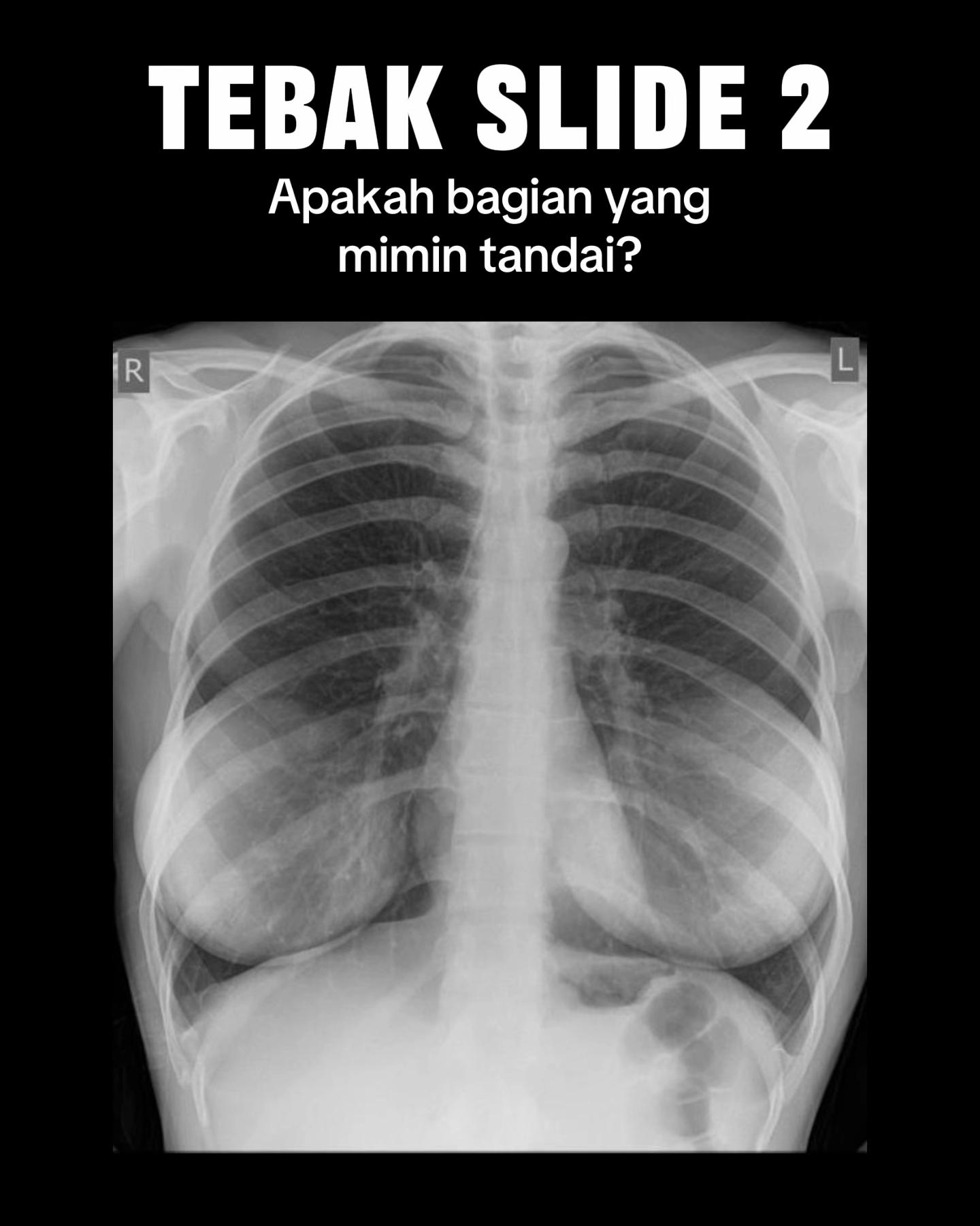 @Sobat Radiology
