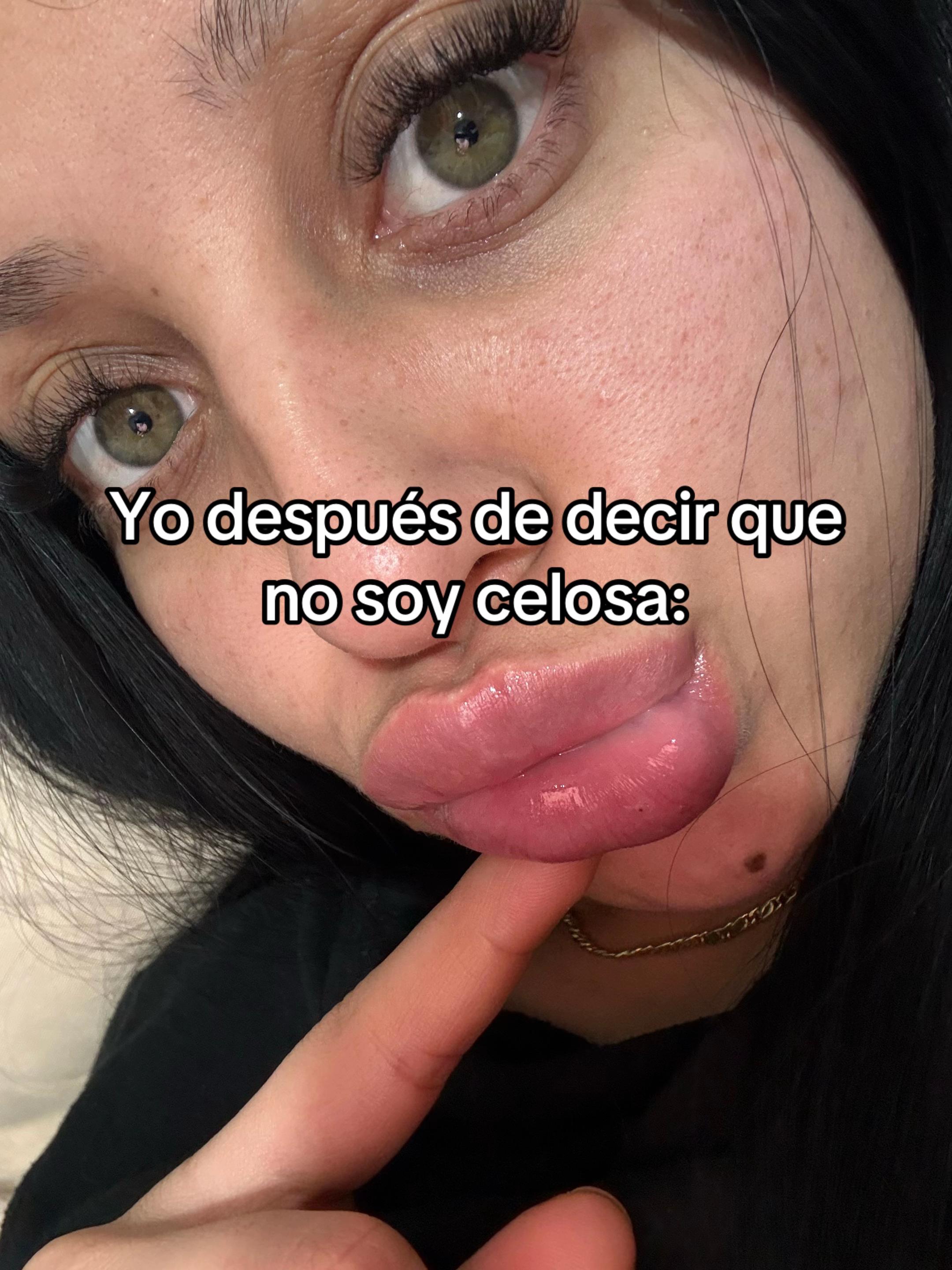@Antonella