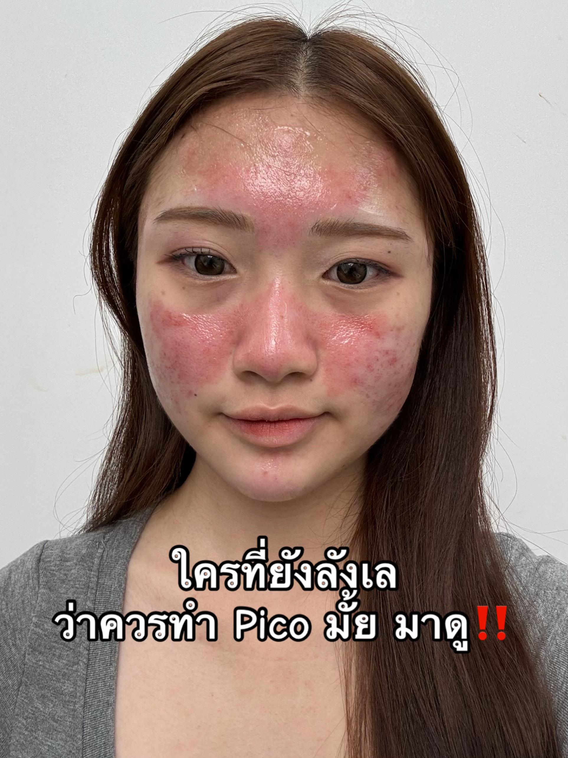 @APEXYOUNGCLINIC