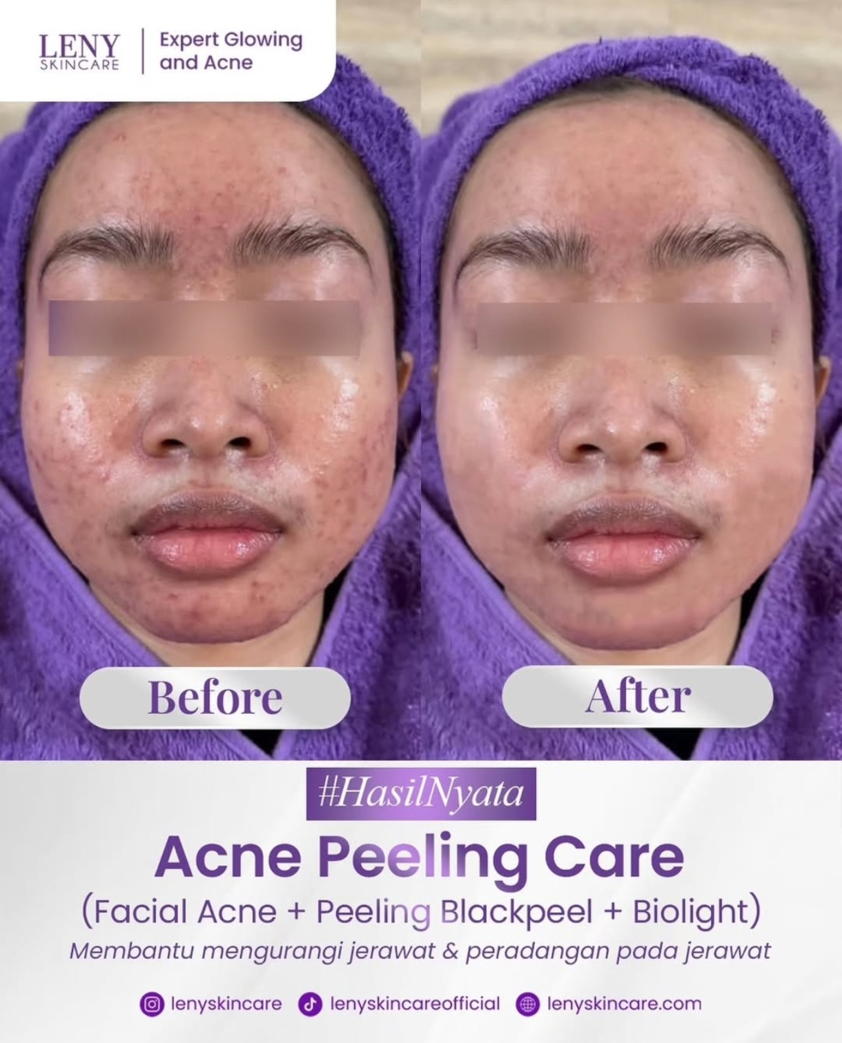@Leny Skincare Karawaci